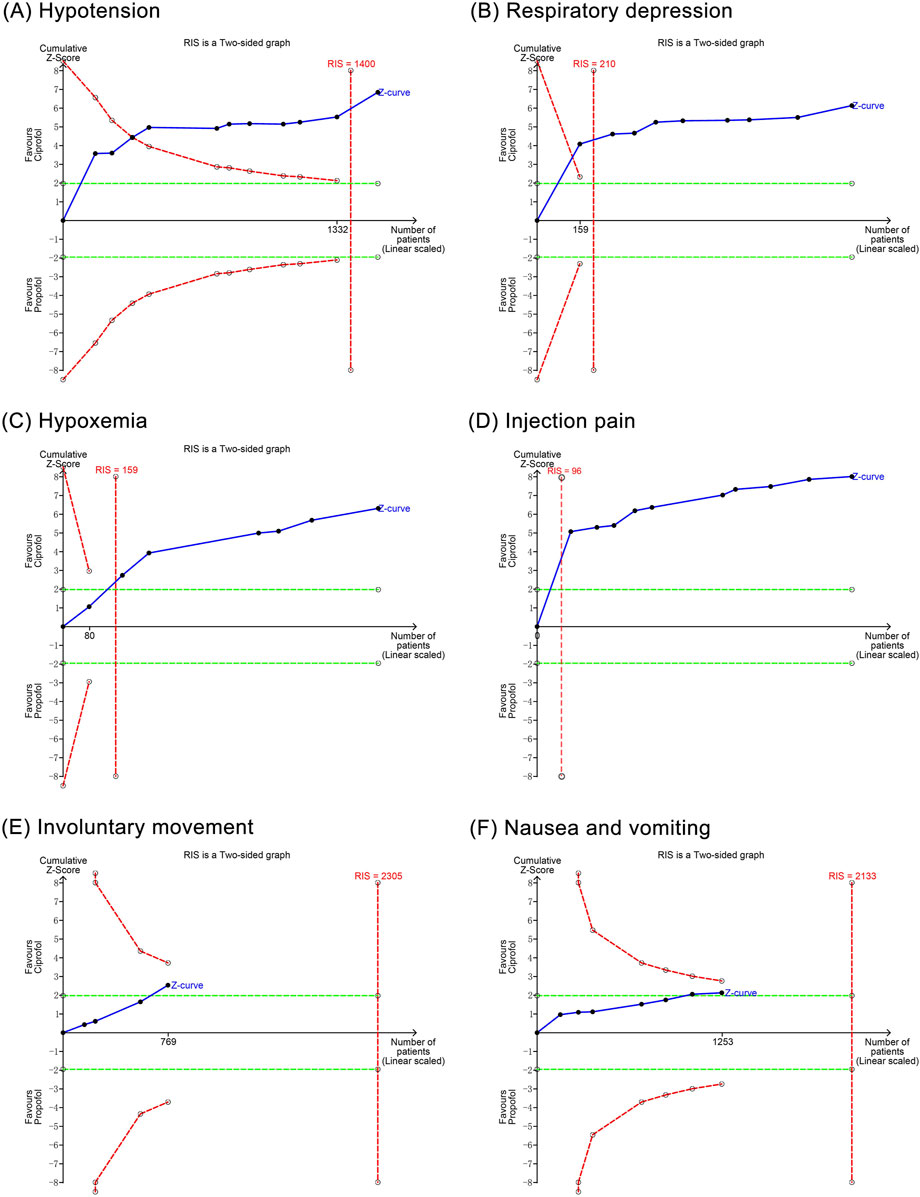 Six two-sided graphs labeled A to F compare various adverse effects. Graph A (Hypotension) and Graph B (Respiratory depression) show Z-curves with risk index scores of 1400 and 210, respectively. Graph C (Hypoxemia) has a score of 159, while Graph D (Injection pain) scores 96. Graph E (Involuntary movement) and Graph F (Nausea and vomiting) show risk index scores of 2305 and 2133, respectively. Each graph includes a cumulative Z-score, a Z-curve, and patient count.