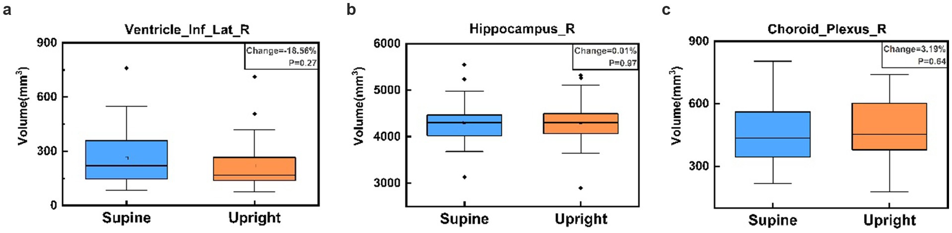 Three box plots comparing volumes in cubic millimeters for supine and upright positions. Plot a: Ventricle Inf Lat R shows an 18.56% volume decrease, p=0.27. Plot b: Hippocampus R shows a 0.01% volume change, p=0.97. Plot c: Choroid Plexus R shows a 3.19% volume increase, p=0.64.