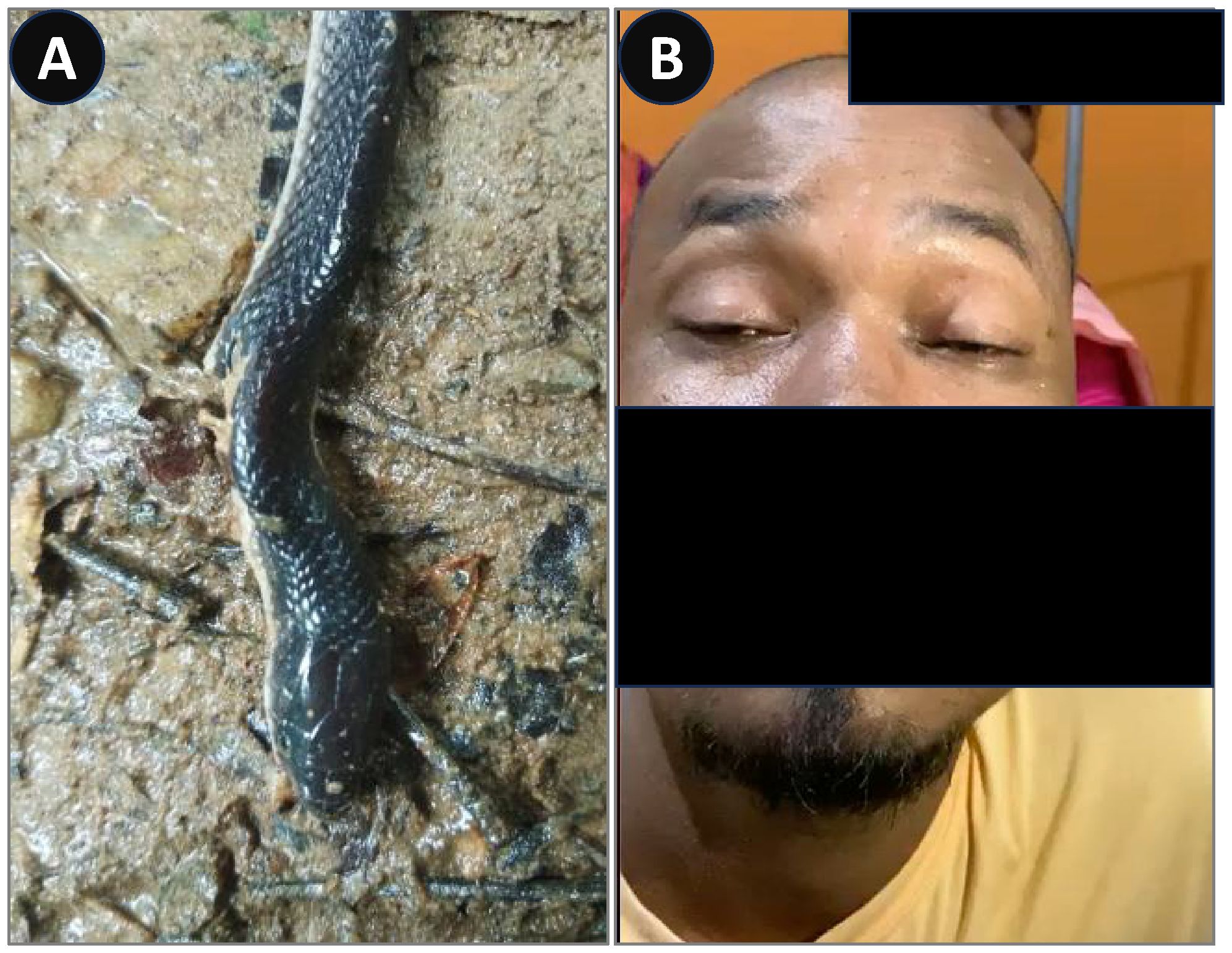 Image A shows a dark-colored snake on a muddy ground, with visible scales and a slender body. Image B shows a person with closed eyes and cropped face, with a partially visible pink garment in the background. Both images are labeled with letters A and B.