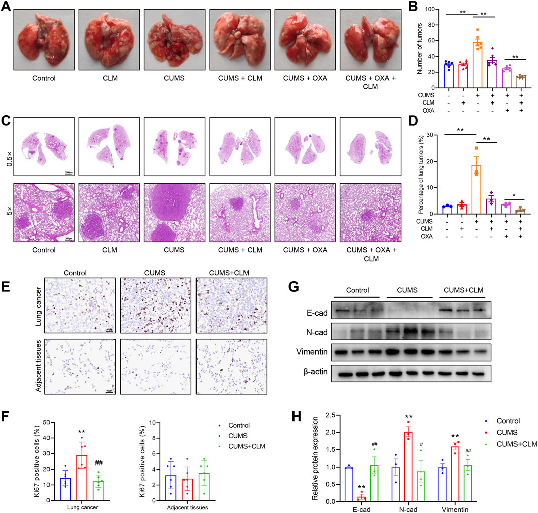 The image contains several panels related to a scientific study on lung tumors. Panel A shows photographs of lungs from different treatment groups: Control, CLM, CUMS, CUMS + CLM, CUMS + OXA, and CUMS + OXA + CLM. Panel B features a bar graph indicating the number of tumors across various treatments. Panel C presents histological lung sections at different magnifications. Panel D displays a bar graph showing the percentage of lung tumors. Panel E includes immunohistochemistry images for Ki-67 in lung cancer and adjacent tissues. Panel F is a bar graph of Ki-67 positive cells percentages. Panel G shows western blot results for E-cadherin, N-cadherin, Vimentin, and beta-actin. Panel H is a bar graph of relative protein expression levels.