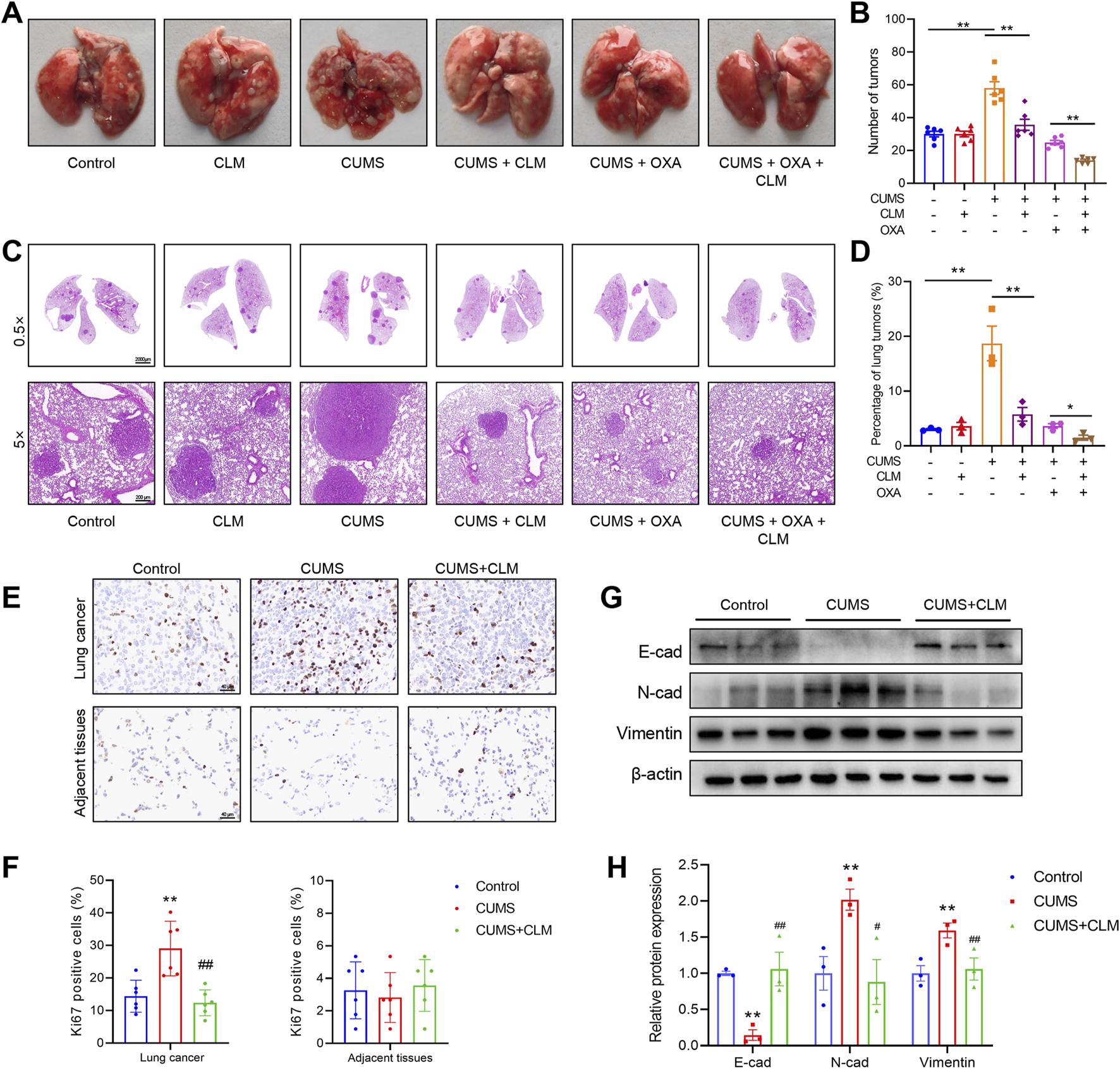 The image contains several panels related to a scientific study on lung tumors. Panel A shows photographs of lungs from different treatment groups: Control, CLM, CUMS, CUMS + CLM, CUMS + OXA, and CUMS + OXA + CLM. Panel B features a bar graph indicating the number of tumors across various treatments. Panel C presents histological lung sections at different magnifications. Panel D displays a bar graph showing the percentage of lung tumors. Panel E includes immunohistochemistry images for Ki-67 in lung cancer and adjacent tissues. Panel F is a bar graph of Ki-67 positive cells percentages. Panel G shows western blot results for E-cadherin, N-cadherin, Vimentin, and beta-actin. Panel H is a bar graph of relative protein expression levels.