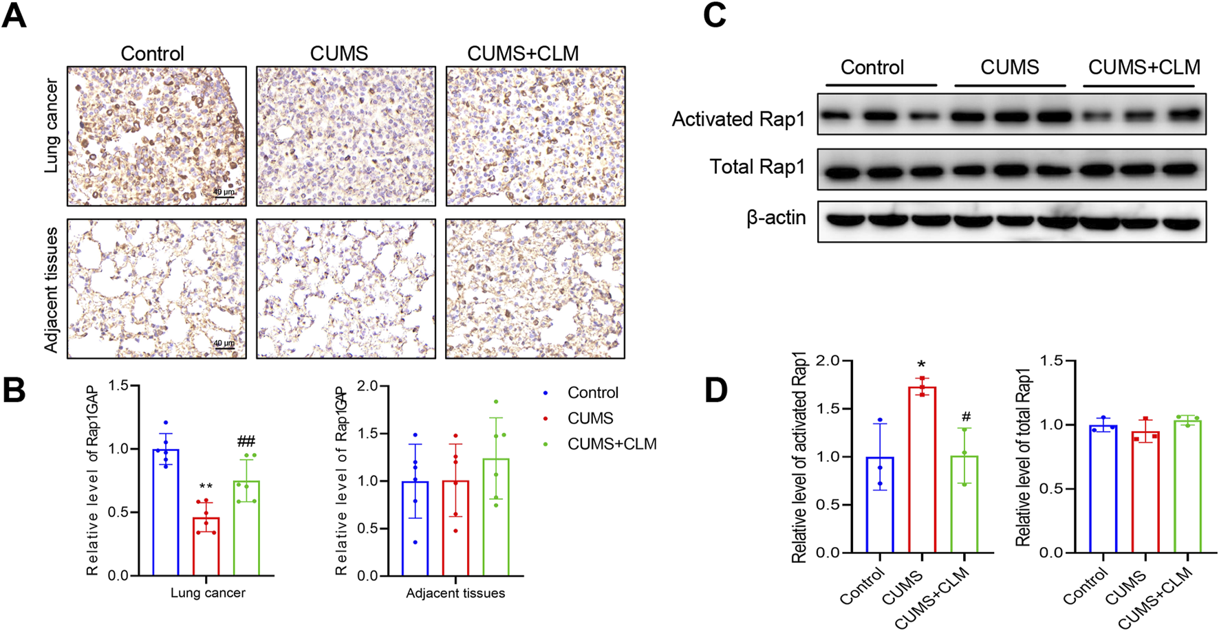 Panels A and B show immunohistochemistry of lung cancer and adjacent tissues under different conditions: Control, CUMS, and CUMS+CLM. Panel C displays Western blot analyses of activated Rap1, total Rap1, and β-actin across the same conditions. Panel D presents bar graphs comparing relative levels of activated Rap1, total Rap1, and Rap1GAP in lung cancer and adjacent tissues, with data represented for Control, CUMS, and CUMS+CLM groups.