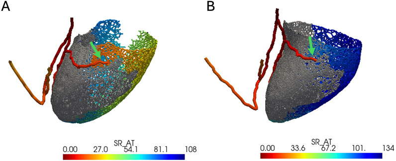 Two 3D models labeled A and B show a complex structure with different colors indicating varying stress levels (SR_AT). A scale from red (low) to blue (high) is displayed below each model. A red vessel-like structure runs through both models, with green arrows pointing at specific regions on the structures. Model A shows more green and yellow, while B shows more blue and darker shades, suggesting changes in stress distribution.
