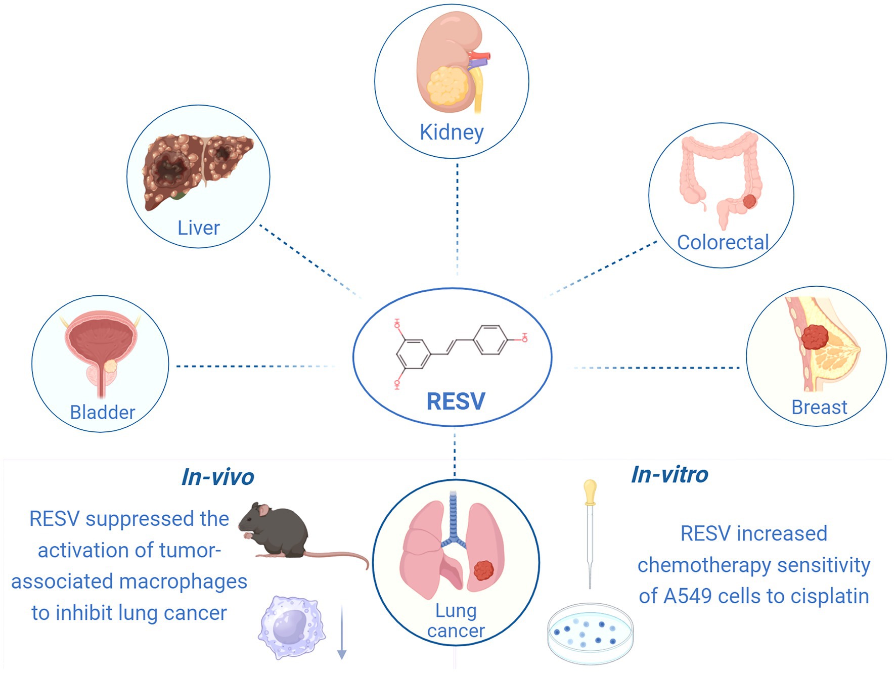 Diagram illustrating the effects of RESV on different organs and cancer types. The top section shows RESV connected to the kidney, colorectal area, breast, liver, and bladder. The bottom section explains RESV’s in-vivo effect in suppressing tumor-associated macrophages to inhibit lung cancer and its in-vitro effect of increasing chemotherapy sensitivity of A549 cells to cisplatin.