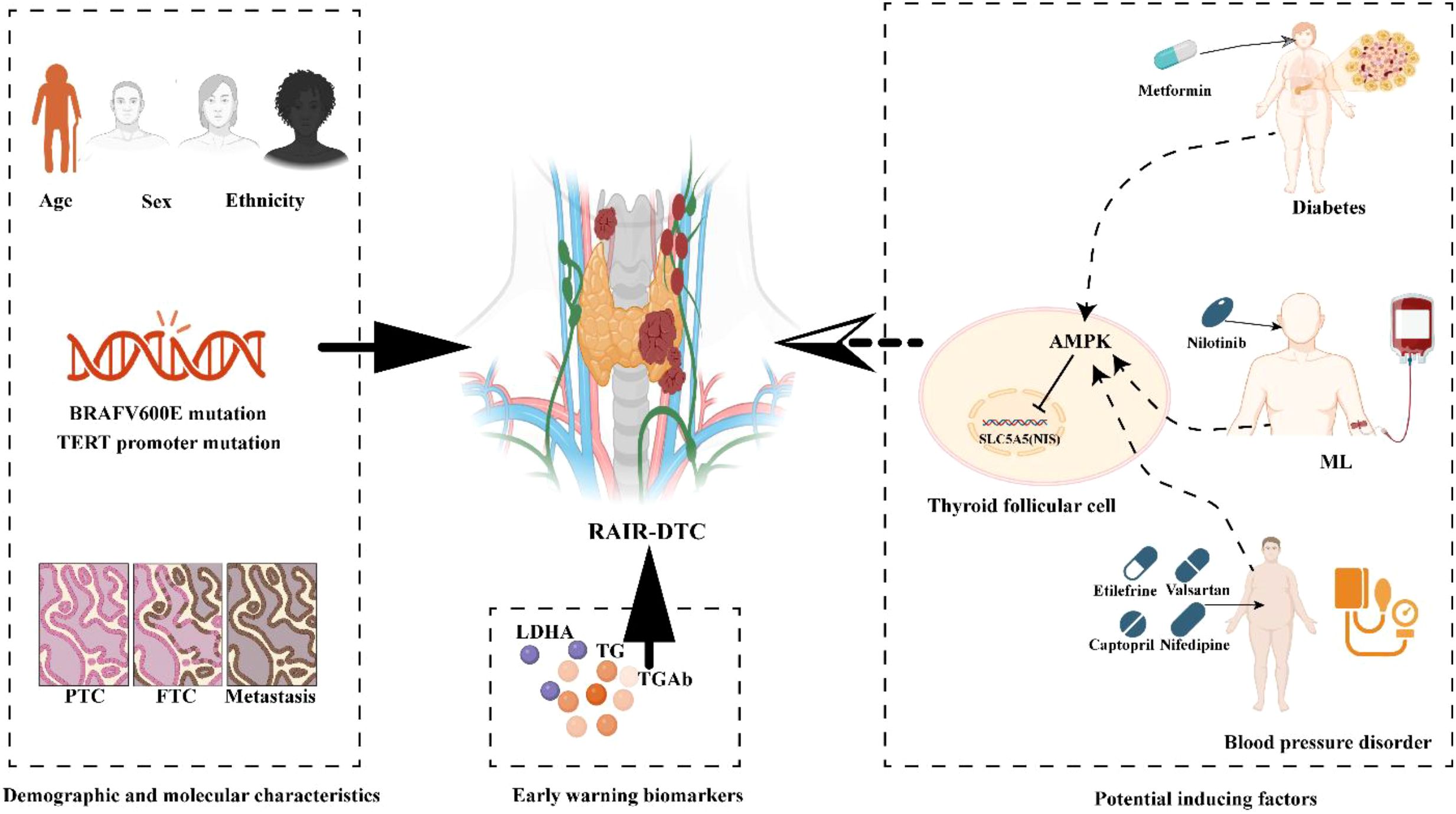 Diagram illustrating factors influencing radioiodine-refractory differentiated thyroid cancer (RAIR-DTC). On the left are demographic and molecular characteristics, including age, sex, ethnicity, BRAF V600E and TERT promoter mutations, and types such as PTC, FTC, and metastasis. The center shows the thyroid gland affected by RAIR-DTC, linked to early warning biomarkers LDHA, TG, and TGAb. On the right, potential inducing factors include diabetes with Metformin, ML with Nilotinib, and blood pressure disorders with medications like Etilifrine and Valsartan. The diagram highlights AMPK's involvement in thyroid follicular cells.
