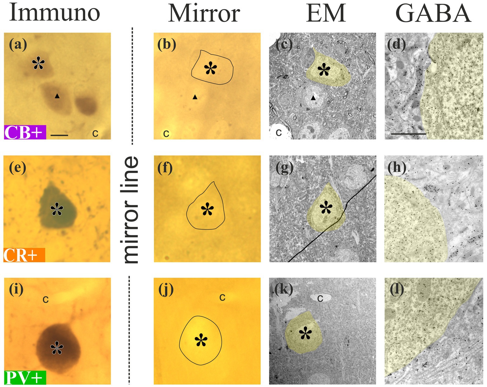 Microscopic images showing neuronal cell labeling. Panels (a), (e), and (i) display immunolabeling for CB, CR, and PV markers, respectively, highlighting cells with asterisks. Panels (b), (f), and (j) show mirrored images with outlined regions around the asterisks. Panels (c), (g), and (k) present the corresponding electron microscopy (EM) views with highlighted areas. Panels (d), (h), and (l) depict GABA staining, showing varied dot densities. Each row corresponds to a specific marker, illustrating different labeling techniques.