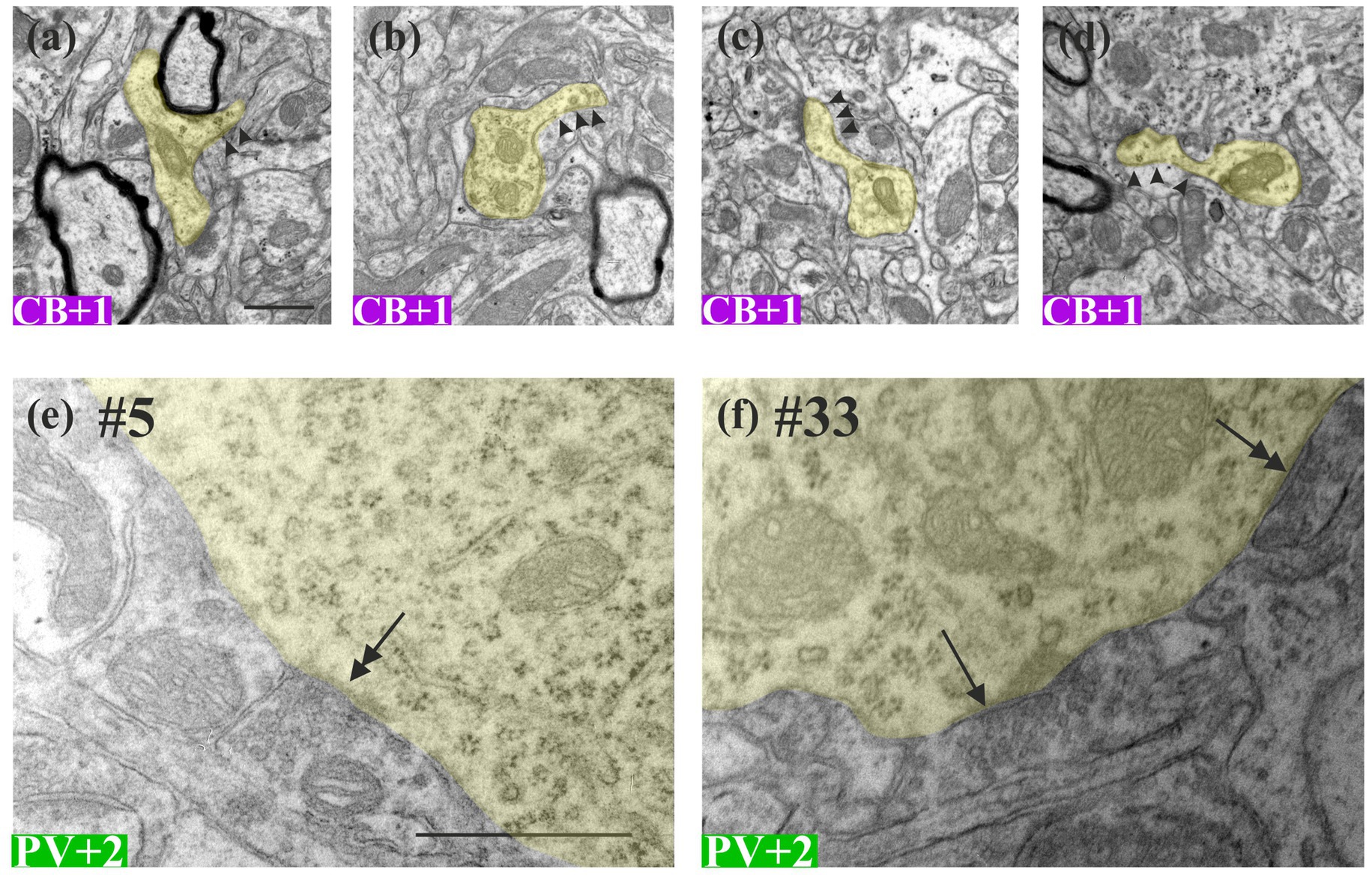 Electron micrographs show different neural structures. Panels (a) to (d) illustrate CB+1 neurons with highlighted areas and arrowheads indicating specific regions. Panels (e) and (f) depict PV+2 neurons with shaded areas and arrows pointing to particular spots. The various shades and labels (#5, #33) differentiate the types of neurons observed.