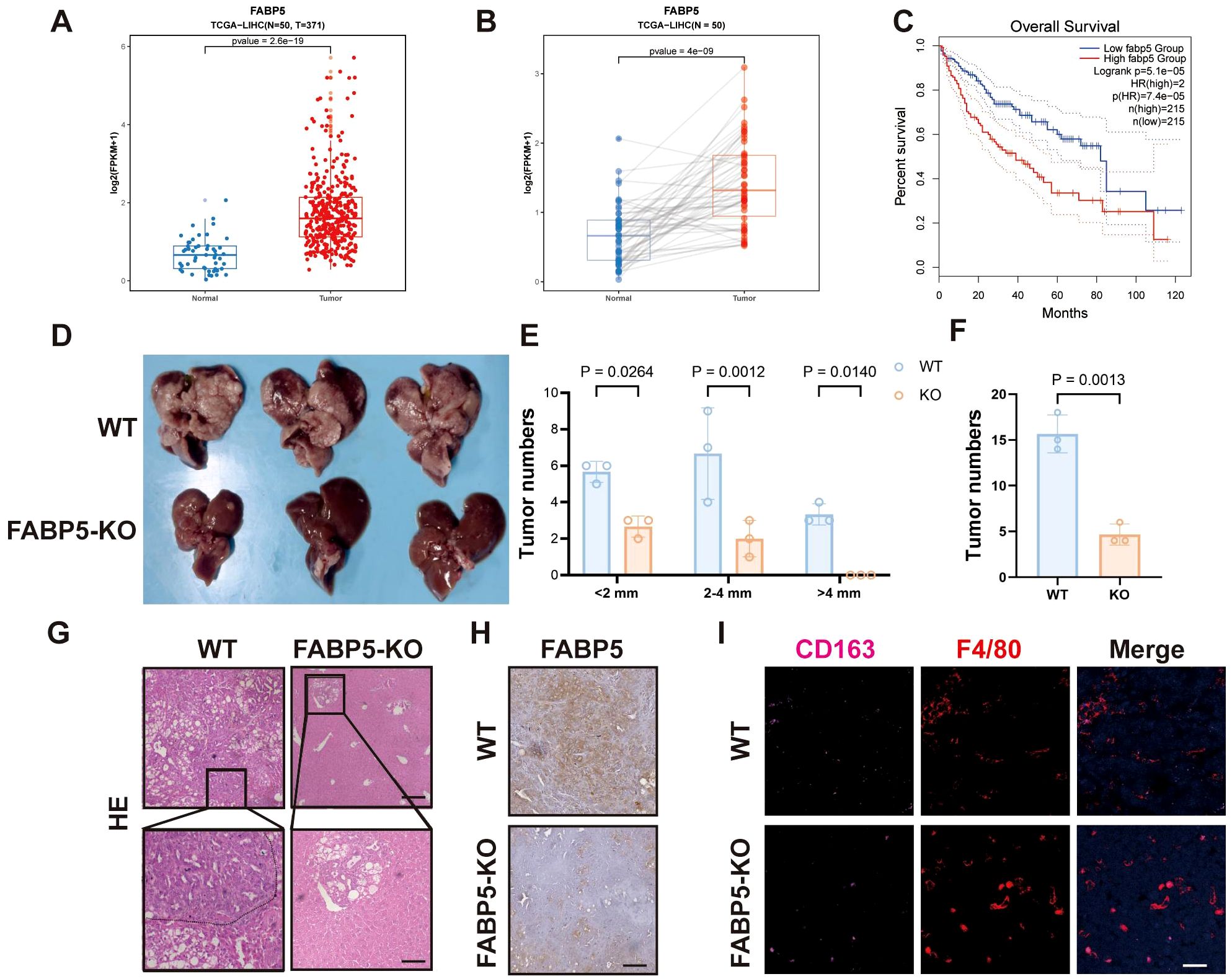 Graph A shows FABP5 expression, with higher levels in tumors. Graph B compares expression between paired normal and tumor samples. Graph C displays overall survival curves, indicating poorer survival with high FABP5. Image D contrasts liver tumors between wild-type (WT) and FABP5 knockout (KO) mice. Graph E indicates fewer tumors in KO mice across sizes. Graph F shows reduced total tumor number in KO mice. Image G provides histological sections of WT and KO tumors. Image H shows FABP5 expression in WT and KO mice. Image I demonstrates CD163 and F4/80 staining, with immune cell distribution differences in WT and KO mice.
