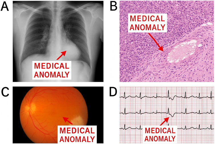 Panel A shows a chest X-ray with a labeled anomaly. Panel B is a microscopic tissue image with a marked anomaly. Panel C depicts a retinal photograph highlighting a specific area. Panel D presents an ECG strip with a pointed-out anomaly.
