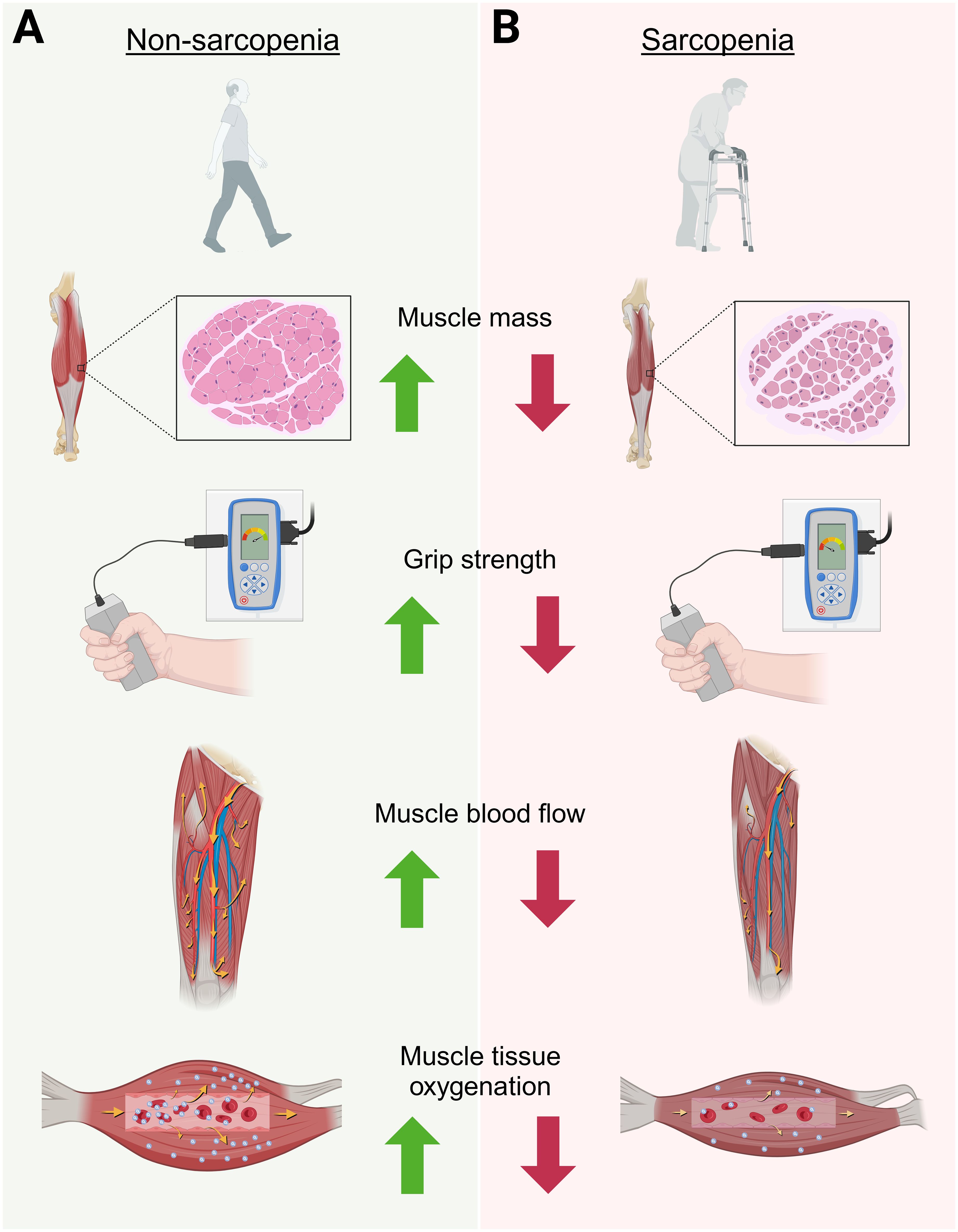 Comparison infographic of non-sarcopenia and sarcopenia states. On the left, labeled “Non-sarcopenia,” depicts a walking person, with muscle mass, grip strength, muscle blood flow, and muscle tissue oxygenation all shown to increase (green arrows). On the right, labeled “Sarcopenia,” shows a person with a walker, with all metrics decreasing (red arrows) including muscle mass, grip strength, muscle blood flow, and muscle tissue oxygenation.