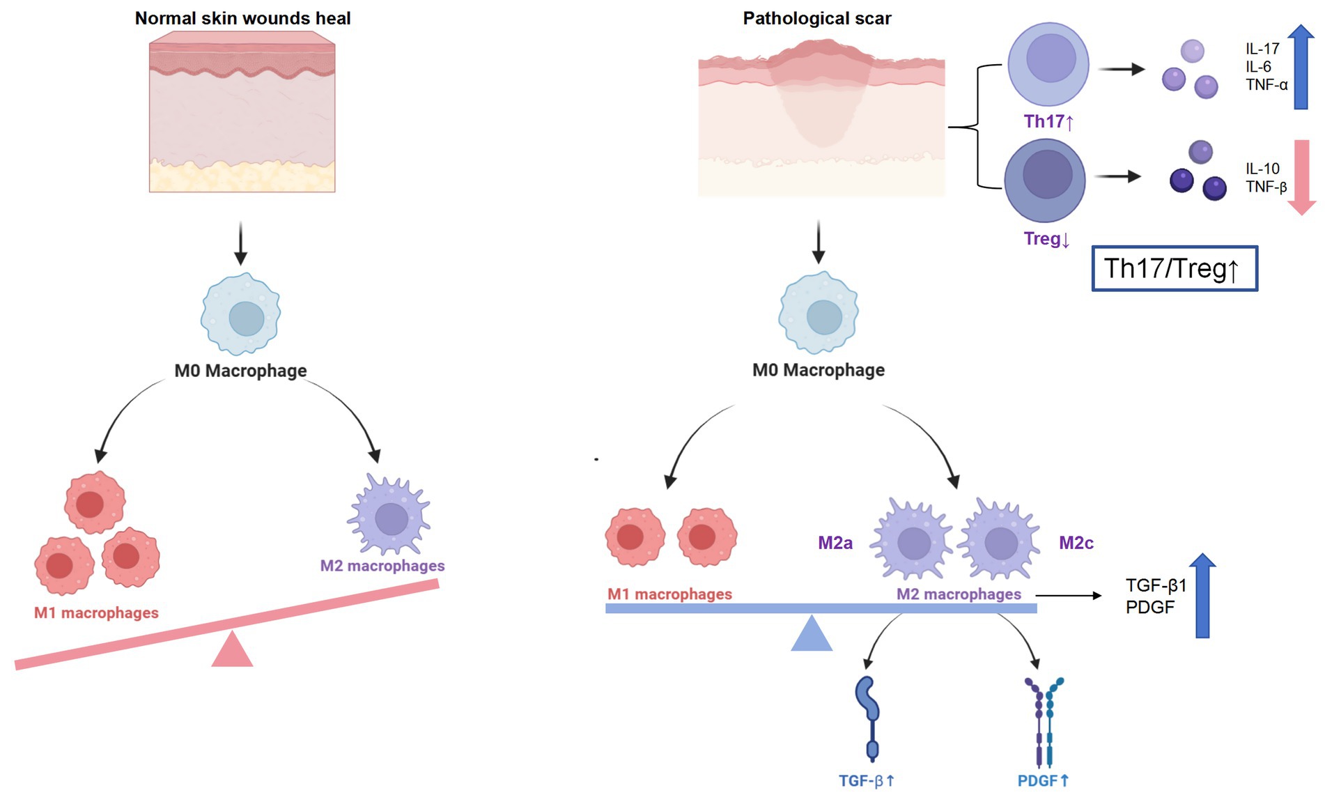 Illustration comparing normal wound healing and pathological scarring. The left side shows normal healing with a tilt towards M2 macrophages over M1. The right side depicts pathological scarring with increased Th17 cells and a Th17/Treg imbalance, increased TGF-β and PDGF, and a shift towards M1 and M2a/M2c macrophages.