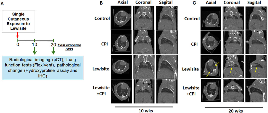 Timeline and CT scans show effects of a single cutaneous exposure to Lewisite on lungs. Panel A outlines the timeline for radiological imaging and tests at 0, 10, and 20 weeks. Panels B and C showcase axial, coronal, and sagittal CT images at 10 and 20 weeks for control, CPI, Lewisite, and Lewisite with CPI. Yellow arrows in Lewisite images highlight notable changes.