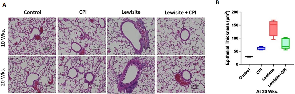 Panel A shows lung tissue histology with four conditions: Control, CPI, Lewisite, and Lewisite plus CPI, at ten and twenty weeks. Purple and pink stains highlight tissue structures. Panel B is a box plot comparing epithelial thickness across these groups at twenty weeks, showing a significant increase in thickness for Lewisite and Lewisite plus CPI compared to CPI and Control.