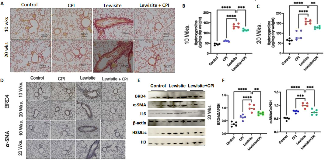 Microscopic lung tissue images and graphs illustrating the effects of different treatments (Control, CPI, Lewisite, Lewisite + CPI) at 10 and 20 weeks. Histological slides (A, D) show tissue structure changes under each condition. Graphs (B, C, F) depict hydroxyproline levels and protein ratios, with significant differences marked by asterisks. Western blot images (E) show protein expression levels for BRD4, α-SMA, IL6, β-actin, H3k9ac, and H3 across treatments. Major findings highlight treatment variations in lung tissue structure and protein expression.