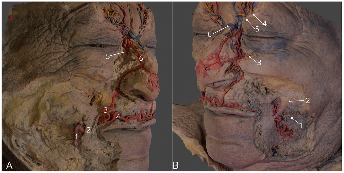 Cross-sectional images of a human torso showing anatomical structures. Image A focuses on a midsection view, with labeled parts indicating various organs and tissues. Image B illustrates a lower section with additional labels highlighting other internal structures. Both images provide a detailed study for educational purposes.