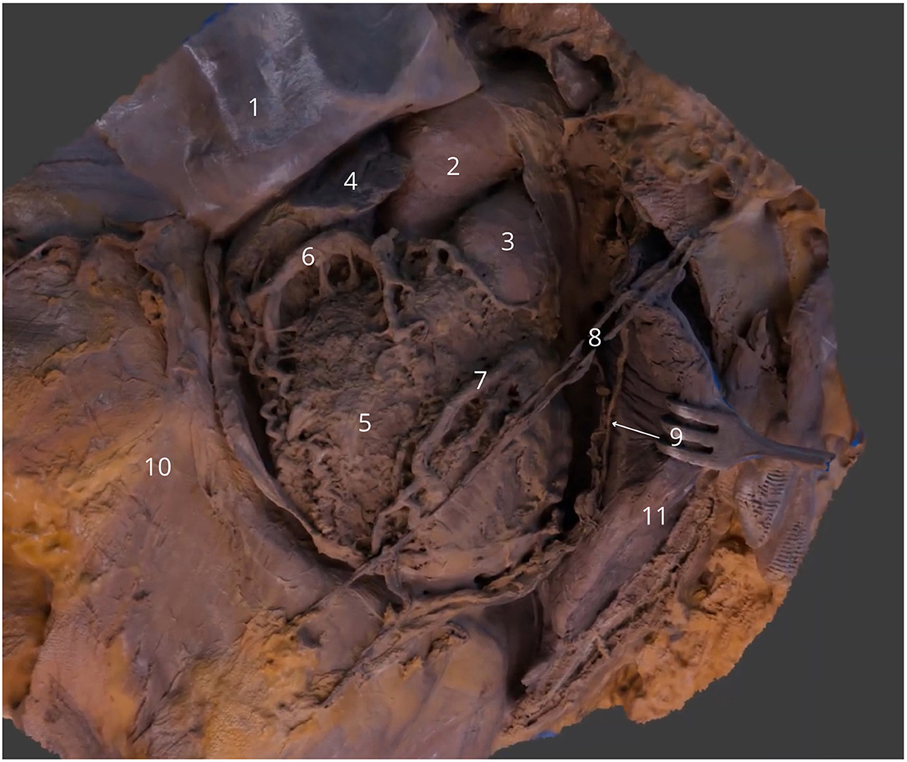 An anatomical dissection image showing numbered sections of tissue and organs. The sections are labeled one to eleven, indicating different parts and structures. The image highlights the complexity of the internal anatomy with detailed textures and colors indicating various tissues and organs.
