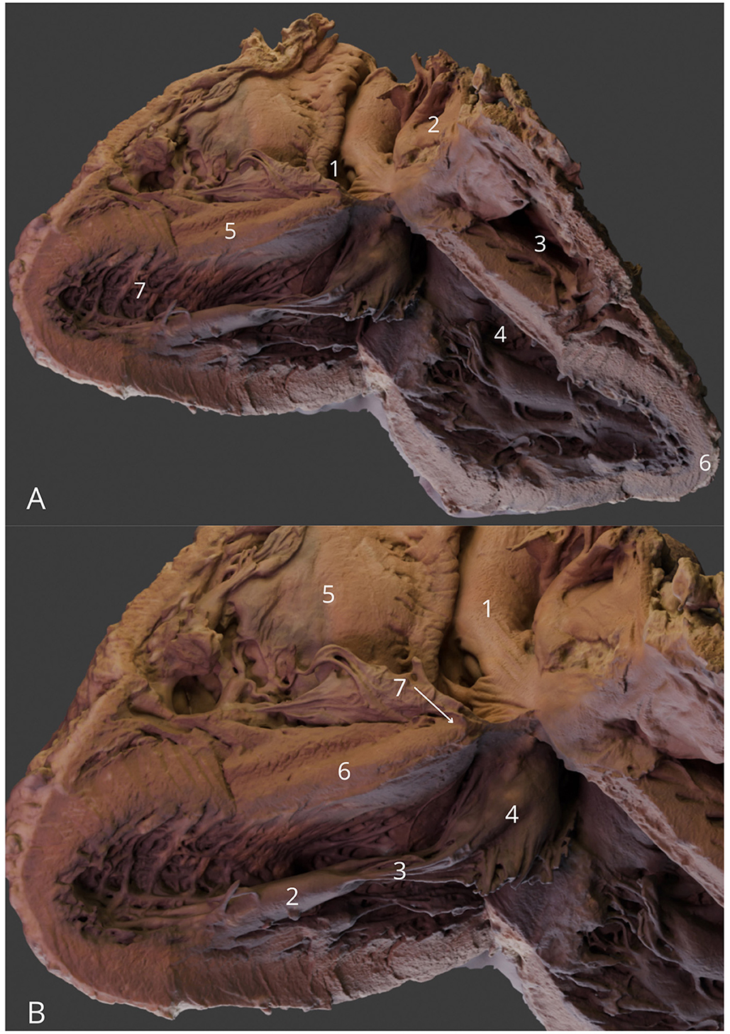 Two labeled images of a dissected heart provide a detailed anatomical view. Both images, labeled A and B, show various heart chambers and structures marked with numbers for educational purposes. The texture and color variations depict different tissues and layers within the heart.