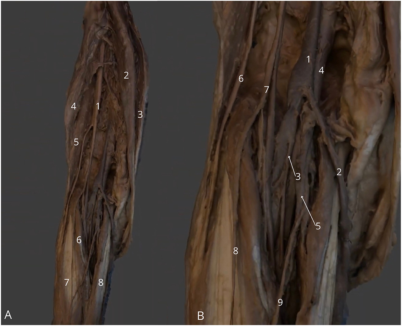 Dissected muscle tissue labeled with numbers, highlighting specific anatomical features. Panel A shows tissue with labels from one to eight. Panel B displays similar tissue with labels from one to nine. Dark background emphasizes the structures.