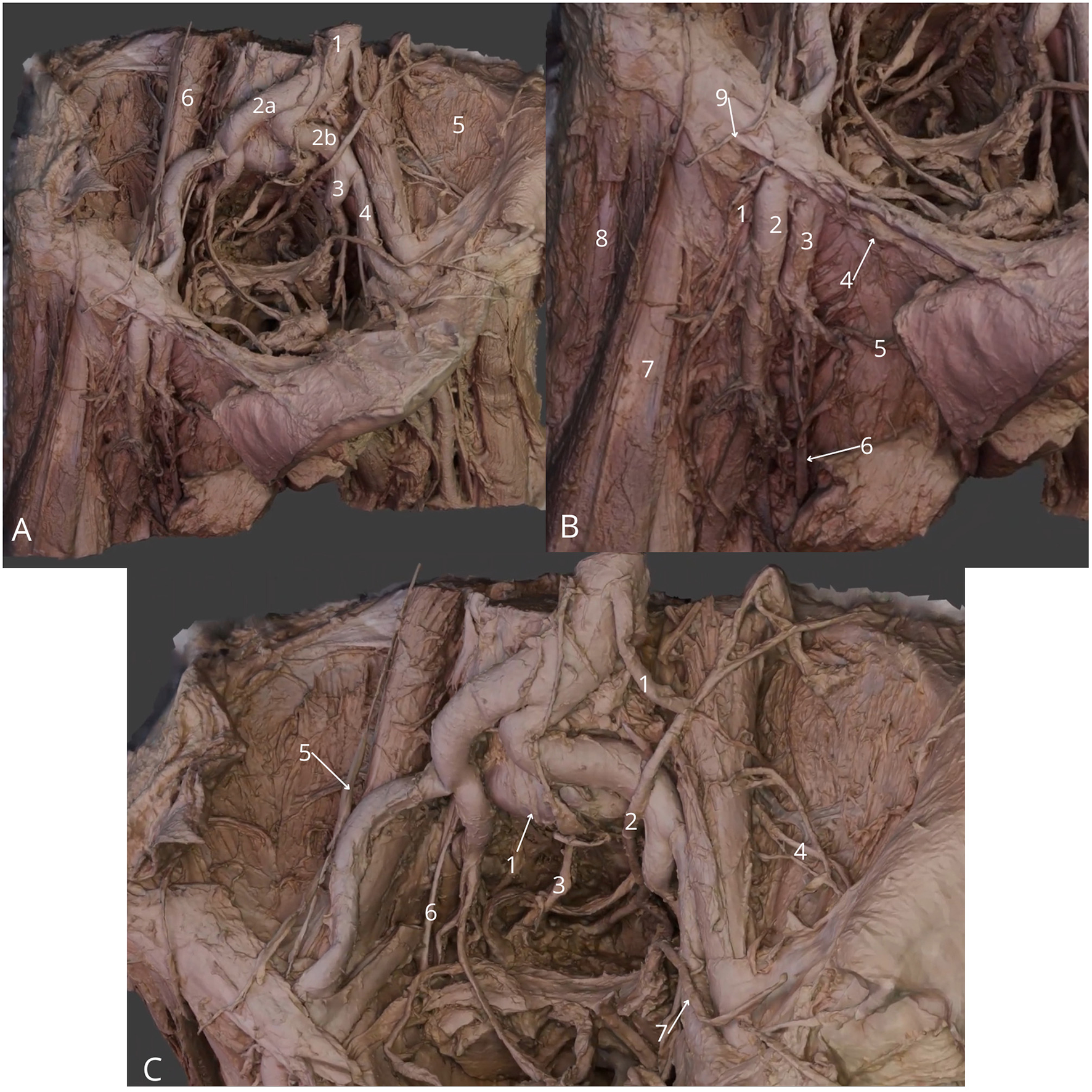 Anatomical dissection images showing detailed views of the neck region with labeled structures. Image A shows the central neck region with several numbered nerves and vessels. Image B is a lateral view highlighting more structures with additional labels. Image C presents a broader perspective of the neck anatomy, showcasing various interconnected components. Each image is marked with specific numbers for identification of anatomical features.