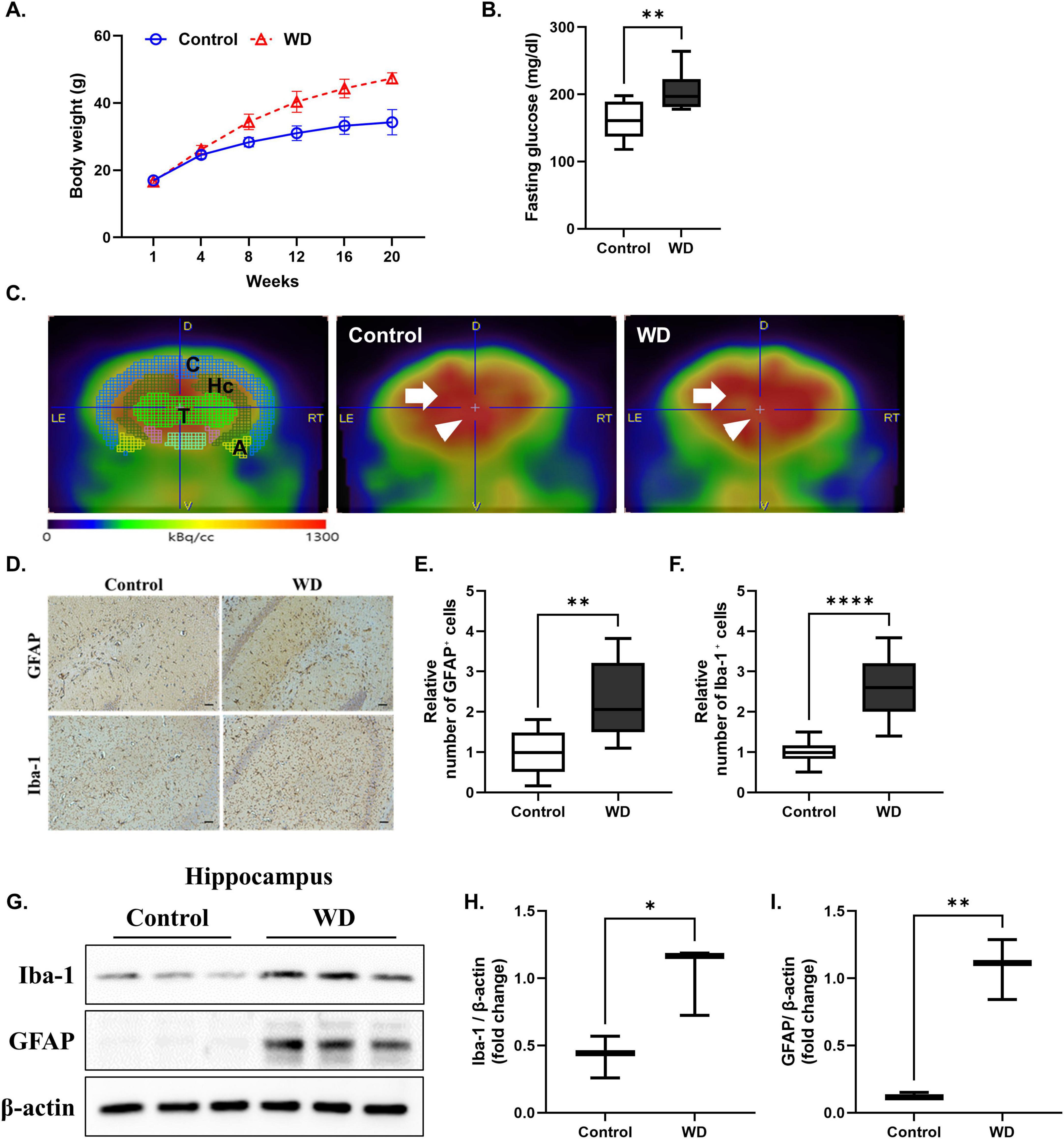 “Western diet induces cerebral glucose hypometabolism, and neuroinflammation. (A) Body weight was significantly increased in mice in the western diet (WD) group compared to that of the normal diet group (control) after 20 weeks of feeding. (B) Fasting glucose levels were also markedly increased in WD group. (C) Representative F-18 FDG PET images and quantification of regional standardized uptake value ratios (SUVRs) revealed significantly reduced glucose metabolism in the bilateral thalamus and left hippocampus of the WD group compared to the control group. The brain regions analyzed included the cortex, hippocampus, thalamus, and amygdala, referred to as C, Hc, T, and A, respectively. (D-F) Representative diaminobenzidine (DAB) staining images of GFAP and Iba-1 in the cerebral cortex, confirming increased glial activation in the WD group. Quantitative analysis demonstrated a significant increase in both GFAP and Iba-1 expression. (G–I) Western blot analysis of hippocampal tissues showing increased expression of Iba-1 and GFAP in the WD group compared to the control group, indicating microglial and astrocytic activation. Data are presented as mean ± SD. Sample sizes: n = 9 (body weight, glucose), n = 7 (western blot), n = 10 slides (immunohistochemistry). Asterisks indicate statistically significant differences compared to the control group with ** p < 0.01, **** p < 0.0001, ns = no significant difference according to Student’s t-test.”