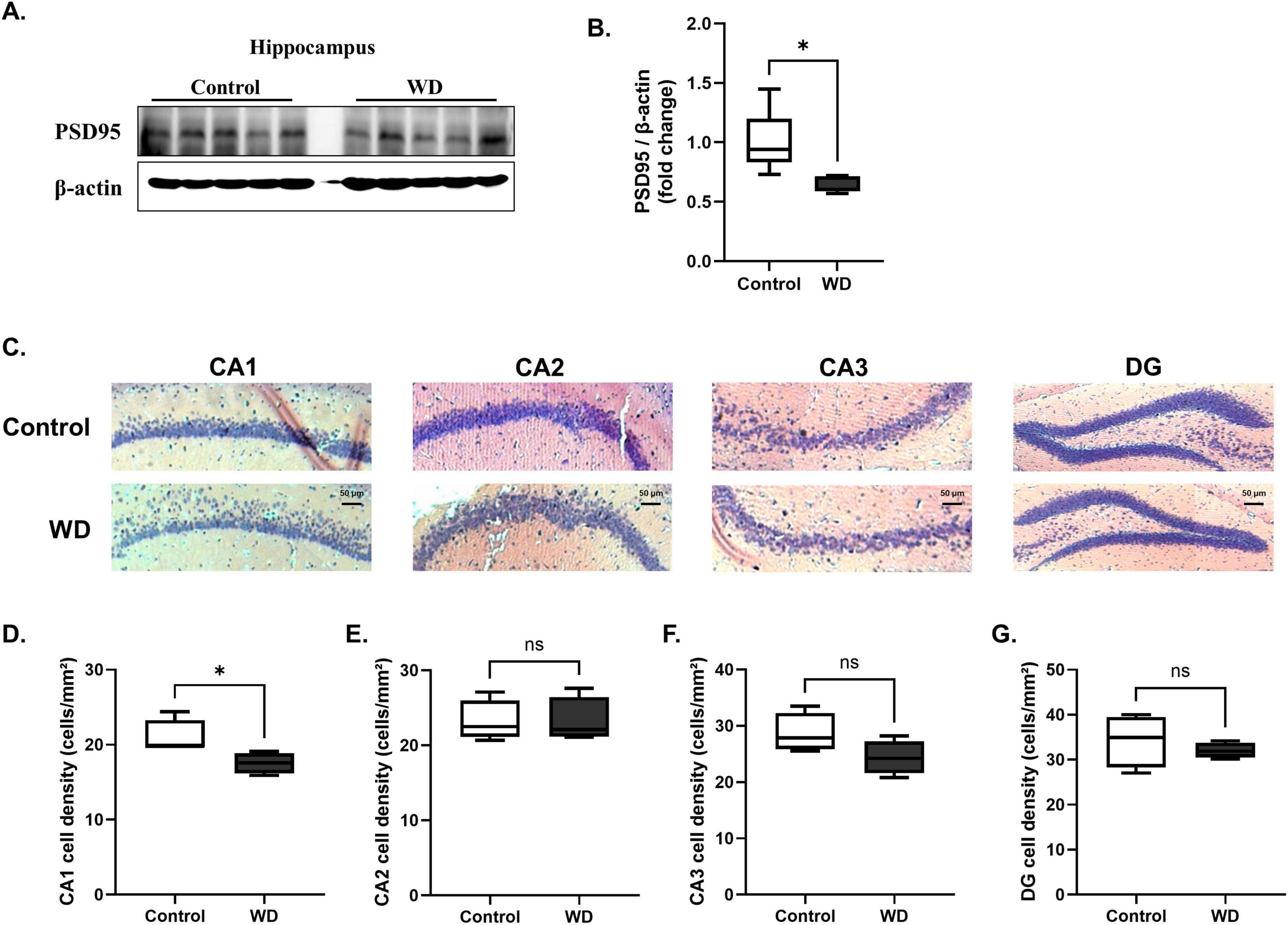 “Western diet induces significant hippocampal neurodegeneration. (A, B) Western blot analysis shows that the synaptic protein PSD95 was significantly decreased in the hippocampus of WD group compared with that in the control group. (C) Representative histological images of hippocampal regions (CA1, CA2, CA3, and DG) stained to assess neuronal density and structure. Images were obtained at 100× magnification, showing notable differences in the hippocampal CA1 region between the WD and control groups. (D-G) Quantitative analysis of neuronal intensity across different hippocampal subregions. Neuronal damage was significantly pronounced in the CA1 region of WD group, with reduced neuronal intensity compared with that in the controls. No significant changes were observed in the CA2, CA3, and DG regions. The results are expressed as mean ± SD with sample sizes of n = 5 for western blot quantification and n = 4 for histological analysis. Asterisks denote statistically significant differences compared with the control group, with * p < 0.05, ns = no significant difference according to Student’s t-test.”