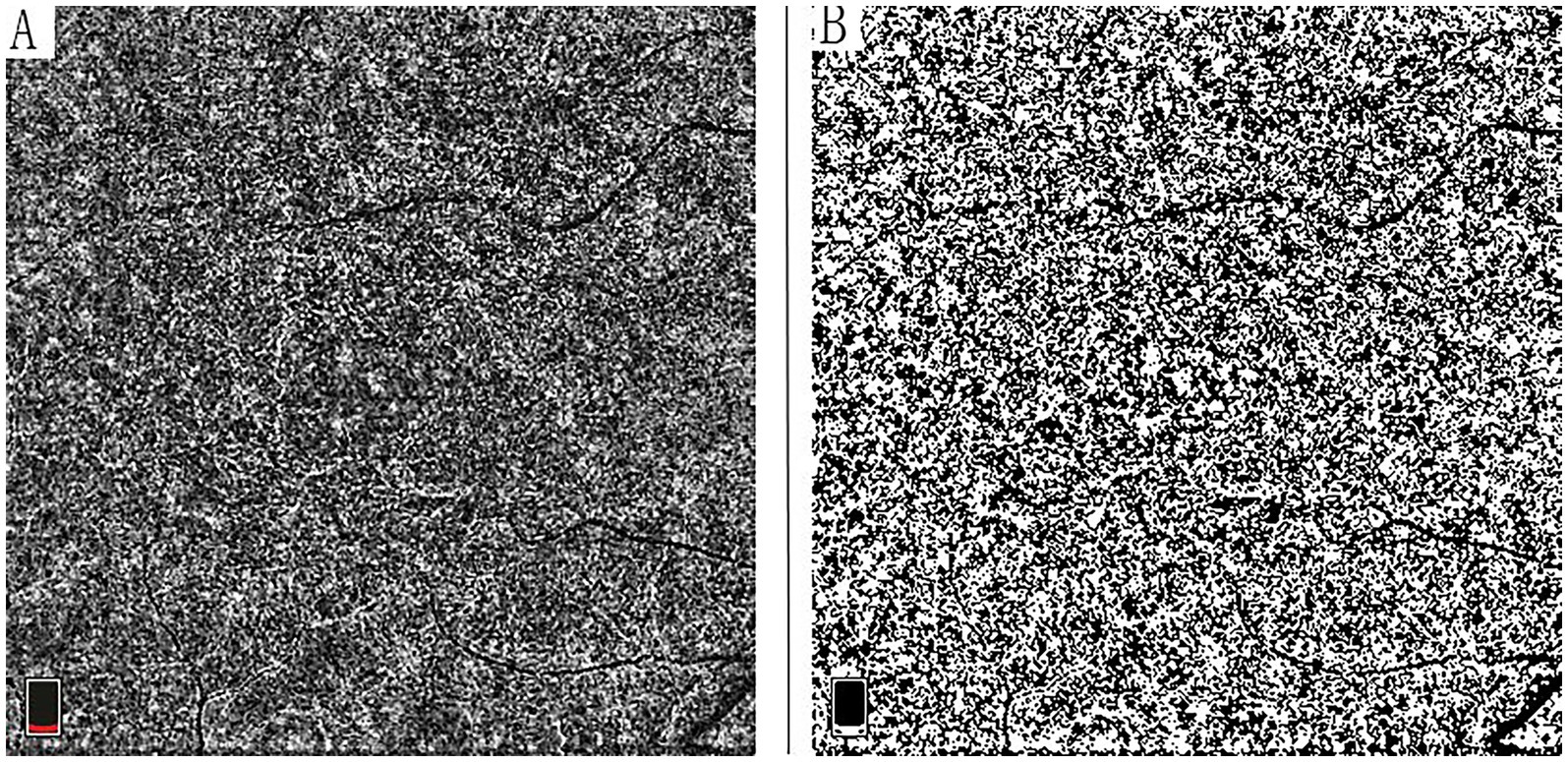 Electron microscopy images labeled A and B. Image A shows a dense, textured pattern with fine granularity, while Image B displays a similar pattern but appears more pixelated and contrasted. Both images have a scale bar in the lower left corner.