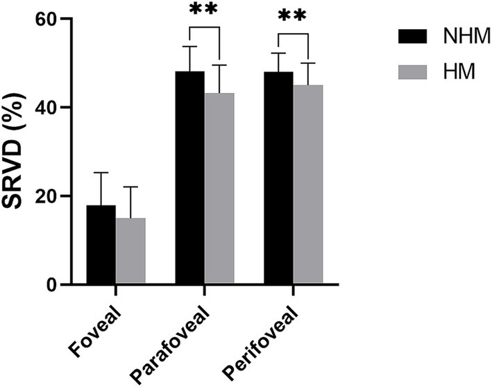 Bar graph comparing superficial retinal vessel density (SRVD) in foveal, parafoveal, and perifoveal regions for NHM and HM groups. NHM shows higher SRVD in parafoveal and perifoveal regions with significant differences (indicated by double asterisks) compared to HM.