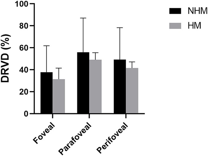 Bar graph comparing deep retinal vascular density (DRVD) percentages across three regions: foveal, parafoveal, and perifoveal. NHM is shown in black, and HM in gray. NHM values are generally higher in all regions.