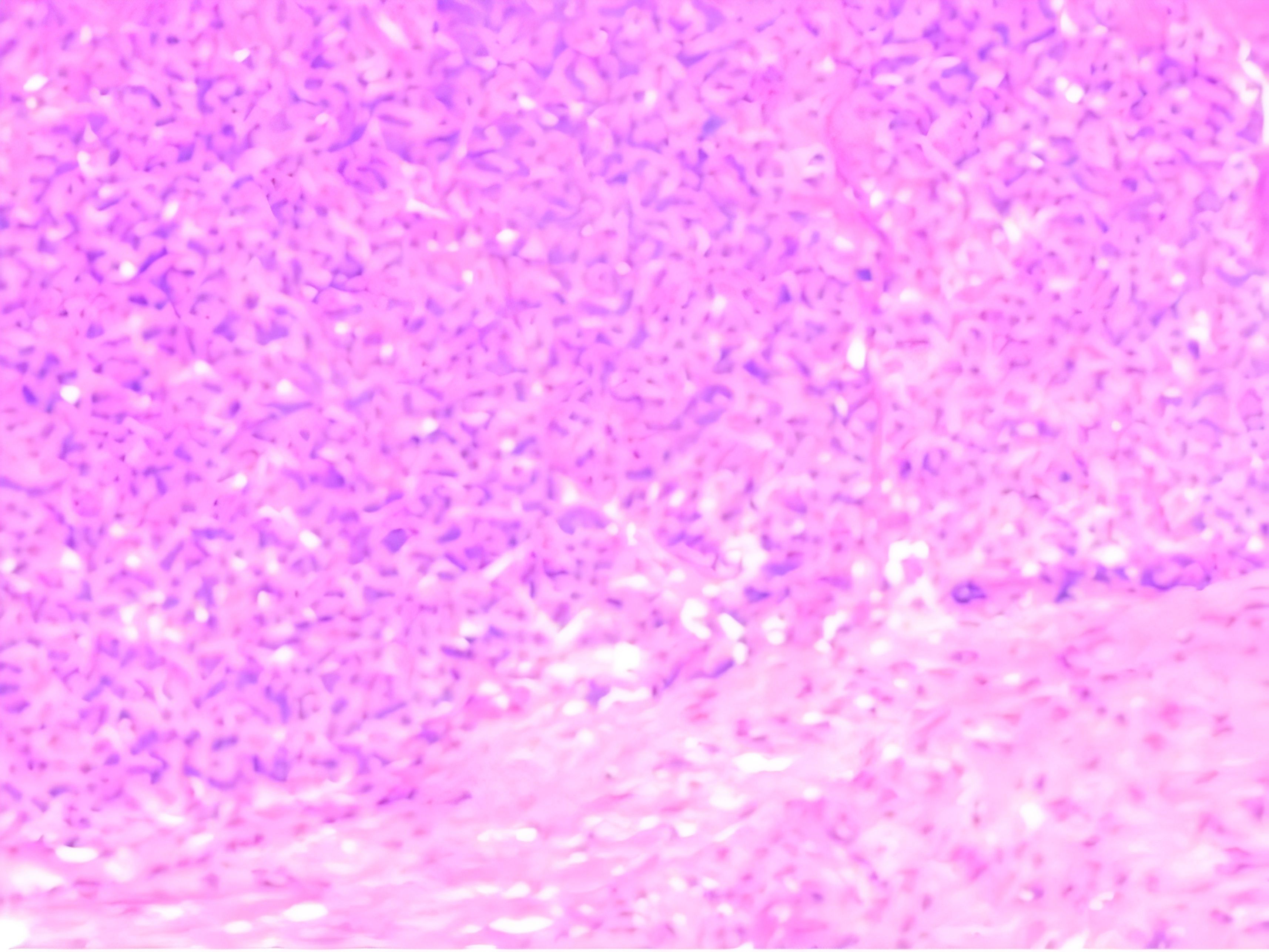 Microscopic view of cells in varying shades of pink and purple. The irregularly shaped cells are densely packed, creating a textured pattern. The colors indicate differences in cell structure or staining.