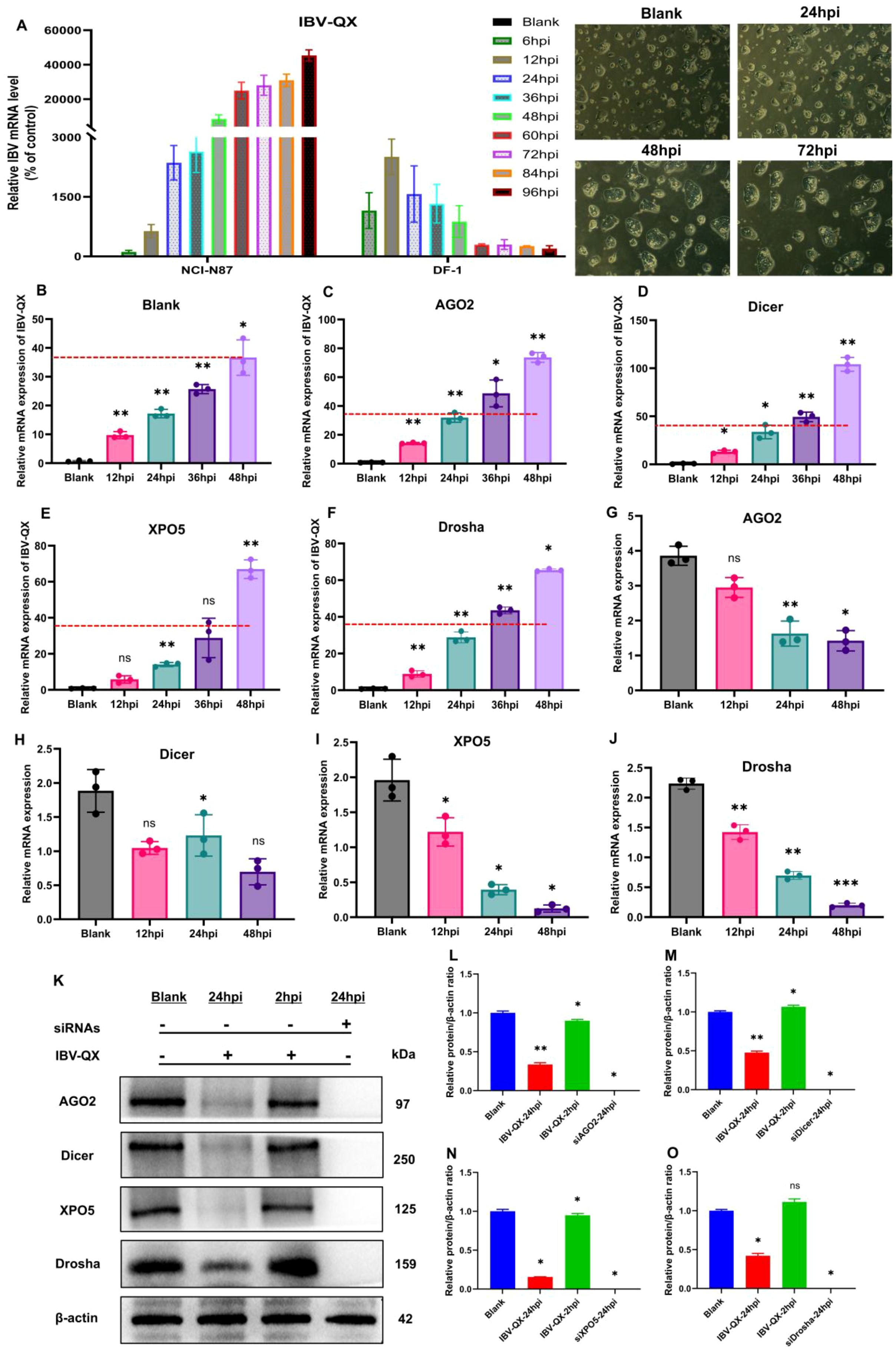 A multi-panel scientific diagram showing various bar graphs and microscopy images analyzing the relative mRNA expression and protein levels in relation to IBV-QX infection. Different time points and conditions are compared, including the use of siRNAs. Key proteins analyzed include AGO2, Dicer, XPO5, and Drosha, with statistical significance indicated by asterisks. Microscopy images display cell morphology at different hours post-infection (hpi). Western blot results and their quantitative analyses are presented at the bottom.