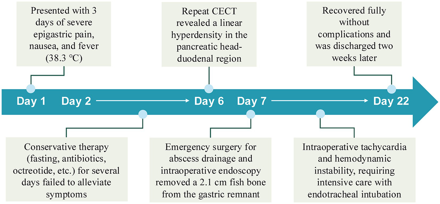 Flowchart depicting a 22-day medical timeline. Day 1: Patient presents with severe epigastric pain, nausea, and fever. Conservative therapy fails. Day 6: Repeat CECT shows linear hyperdensity. Day 7: Emergency surgery removes a 2.1 cm fish bone. Intraoperative complications require intensive care. Day 22: Patient recovers fully and is discharged.