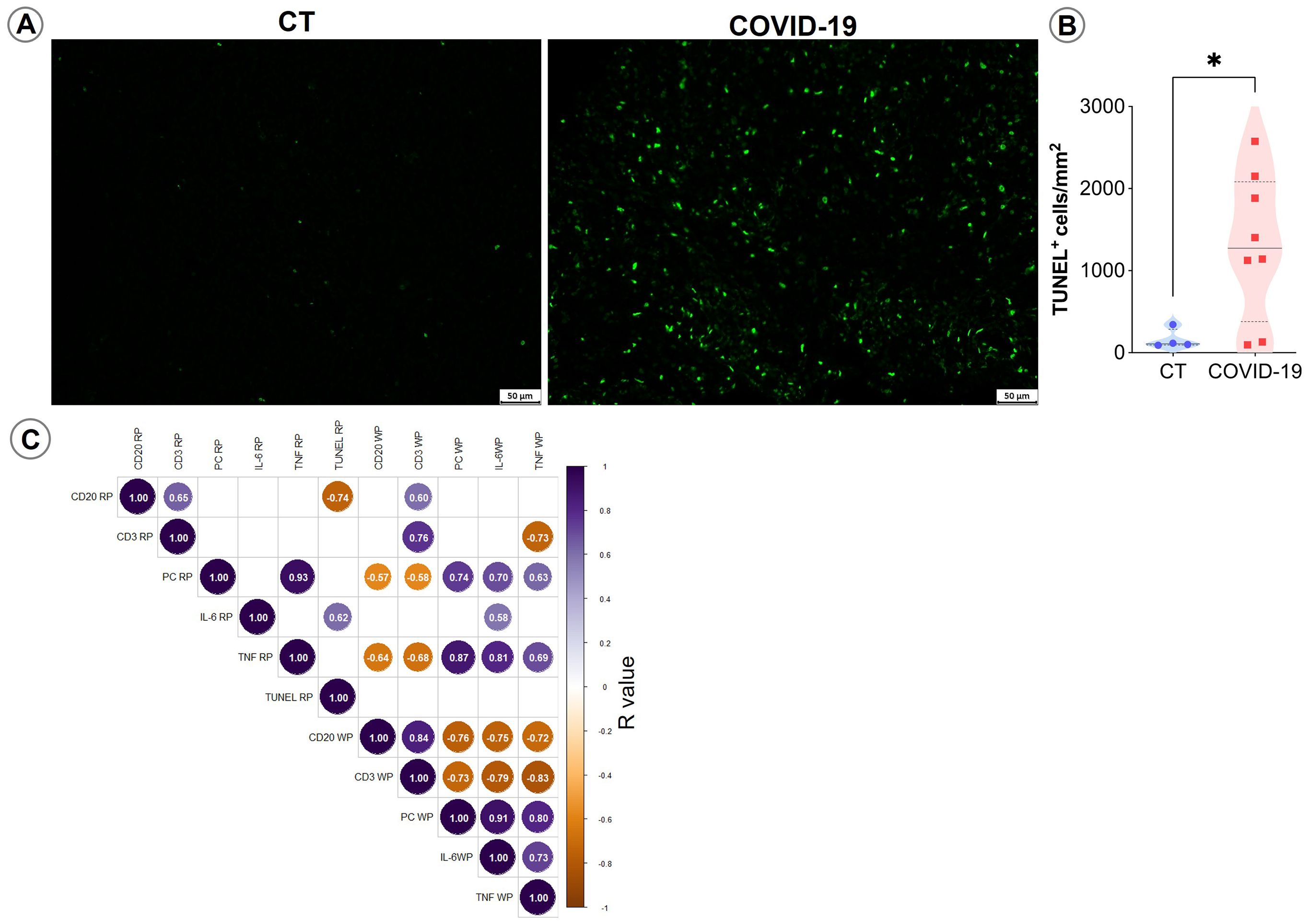 Panel A shows two fluorescent microscopy images comparing CT and COVID-19 samples, highlighting increased green fluorescence in COVID-19. Panel B features a violin plot showing a higher number of TUNEL-positive cells in COVID-19. Panel C displays a correlation matrix heat map with color gradients indicating different correlation coefficients for various markers, showing both positive and negative correlations.