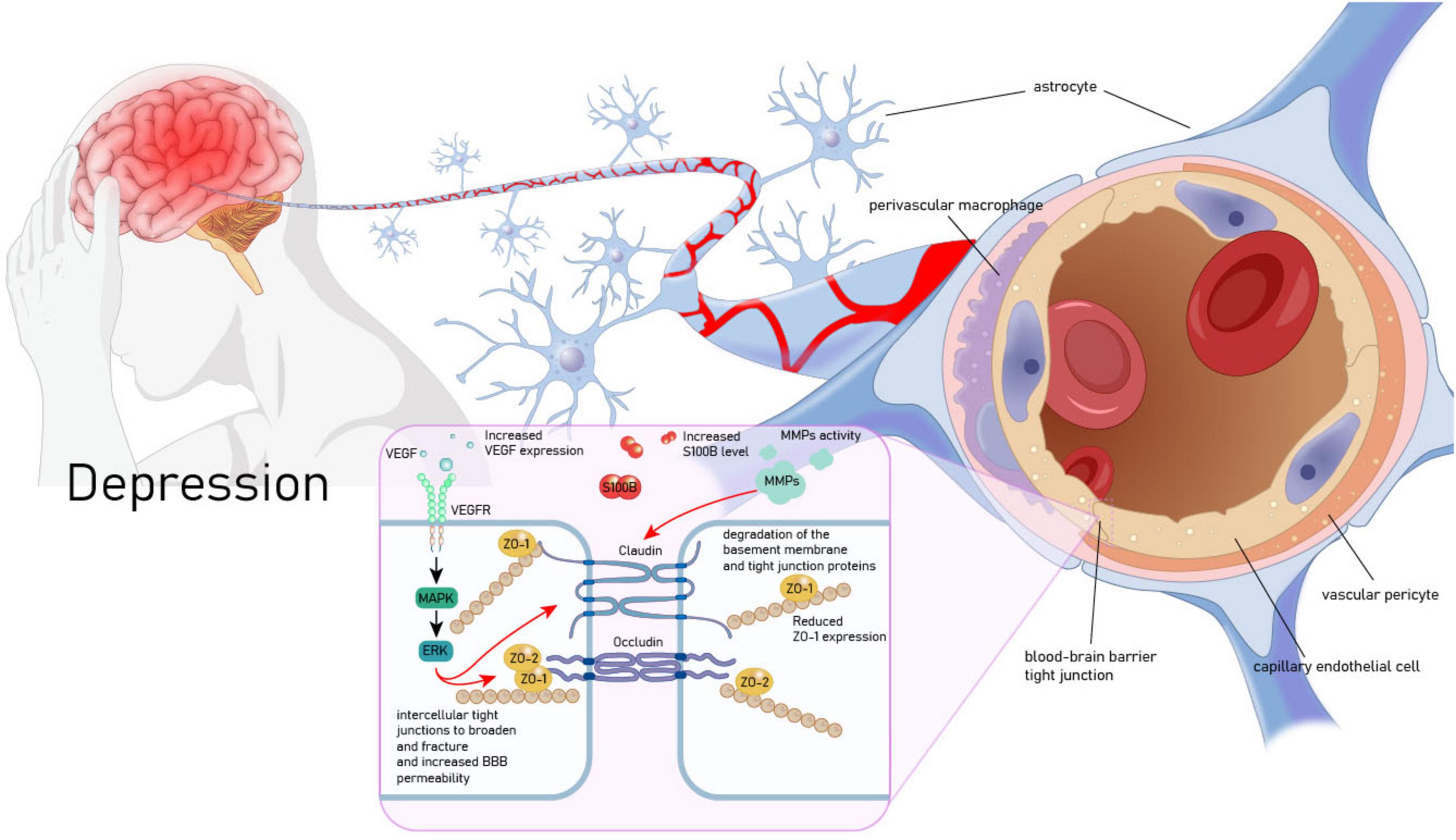 Illustration depicting the impact of depression on the blood-brain barrier. On the left, an outline of a person holding their head with the word “Depression” beside it. The image transitions to a detailed cellular view showing neurons, a perivascular macrophage, and a zoomed-in section of a blood vessel. The blood vessel is labeled with vascular pericytes, endothelial cells, and tight junctions. An inset diagram outlines the VEGF pathway, S100B level increase, and MMP activity leading to junction degradation and increased permeability.