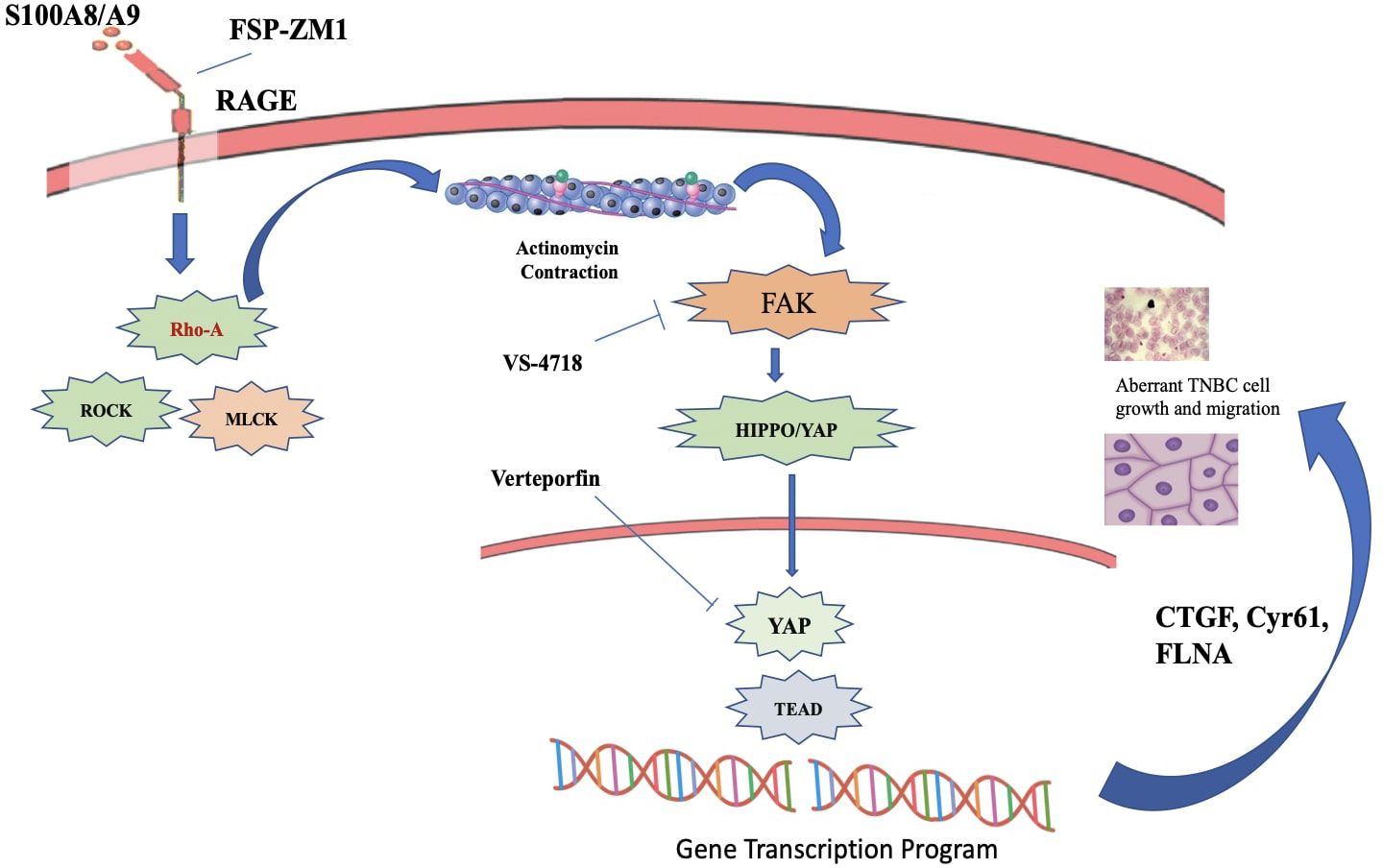 Diagram illustrating the signaling pathway involving S100A8/A9 and RAGE, leading to Rho-A activation, which affects ROCK and MLCK. FAK activation follows, inhibited by VS-4718. The HIPPO/YAP pathway components, modulated by Verteporfin, influence gene transcription. Illustrations depict actinomycin contraction and aberrant TNBC cell growth and migration, associated with CTGF, Cyr61, and FLNA. DNA and cell structures are highlighted.