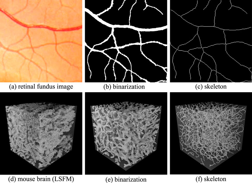 Top row shows three images related to retinal fundus imaging: (a) a colored retinal fundus image with visible blood vessels, (b) a black-and-white binarization of the vessels, and (c) a skeletal representation of the vessel structure. The bottom row displays three images of a mouse brain using Light Sheet Fluorescence Microscopy (LSFM): (d) a 3D representation of the brain, (e) its binarized form highlighting vessel structures, and (f) the skeletal outline of these structures.