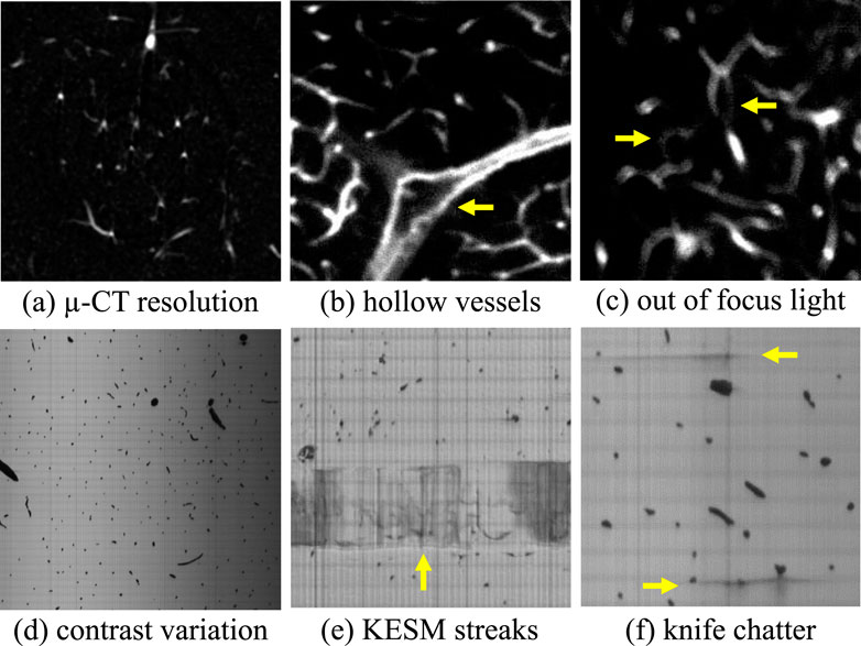Composite image showing various imaging artifacts: Panel (a) displays micro-CT resolution with faint structures. Panel (b) shows hollow vessels, indicated by an arrow. Panel (c) highlights out of focus light with arrows pointing to blurred areas. Panel (d) presents contrast variation with speckled features. Panel (e) exhibits KESM streaks with a vertical line, marked by an arrow. Panel (f) illustrates knife chatter, with arrows pointing to discontinuous lines.