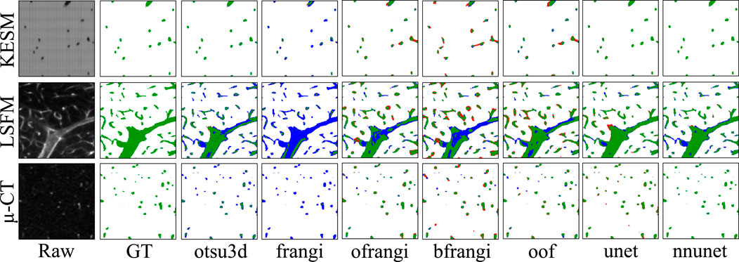 Comparison of vascular image segmentation techniques using KESM, LSFM, and µ-CT imaging modalities. Each row shows results for one modality, with columns labeled as Raw, GT, otsu3d, frangi, ofrangi, bfrangi, oof, unet, and nnunet. Segmentation results show color-coded vessel structures against a white background.