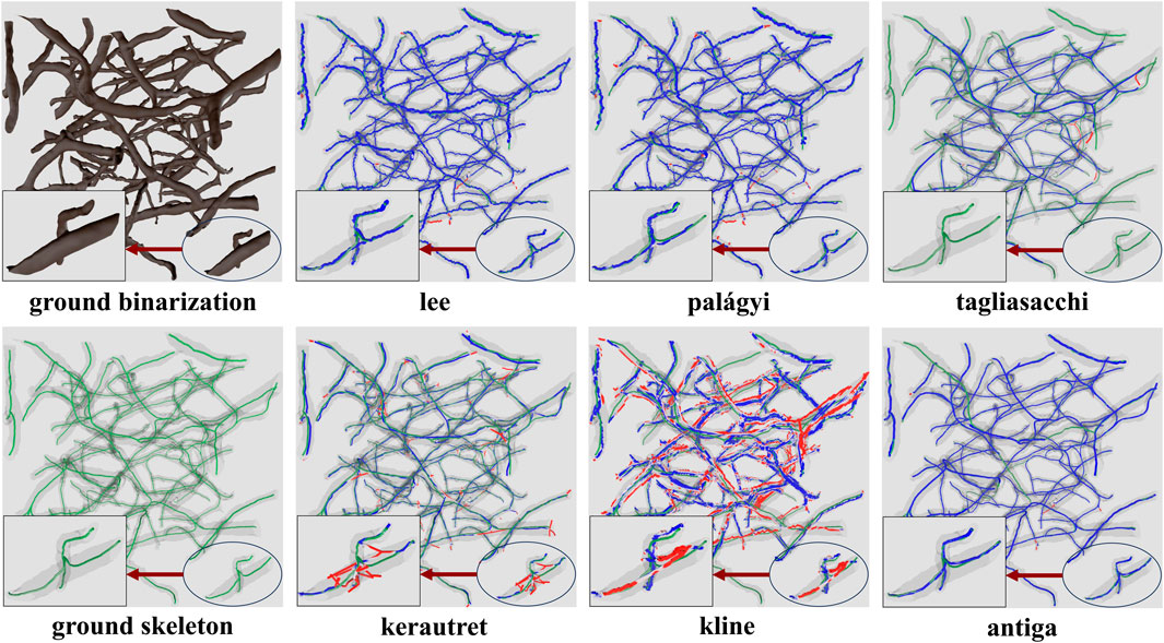 Comparison of six binarization and skeletonization techniques: ground binarization shows a brown branched structure; Lee, Palágyi, Tagliasacchi, Kerautret, Kline, and Antiga show blue and green filamentous structures, some with red highlights indicating differences in processing methods. Inset images provide close-ups of detail variations.