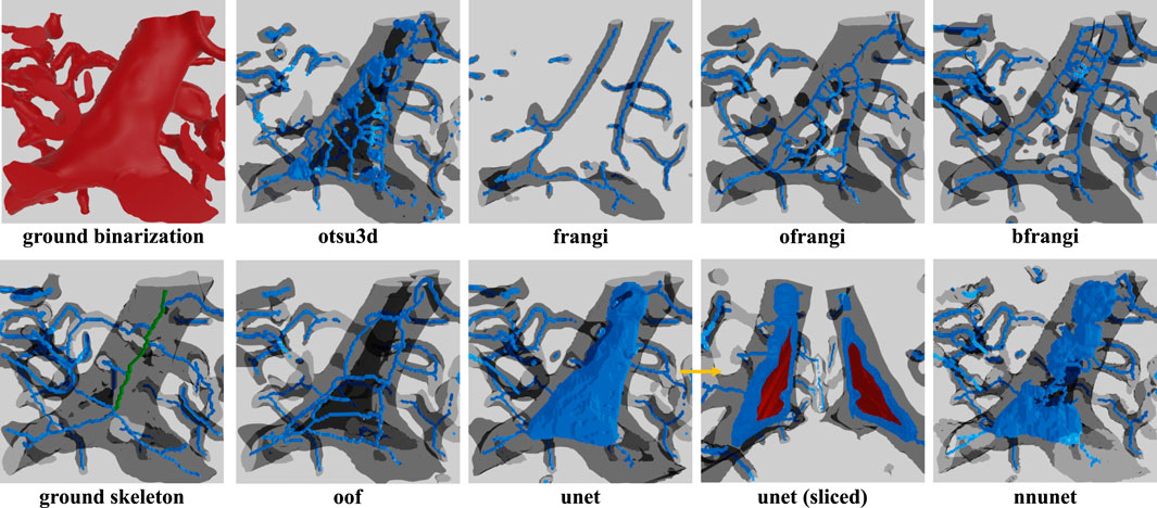 Image depicting a comparison of various image processing techniques applied to a 3D structure. The top row shows results from