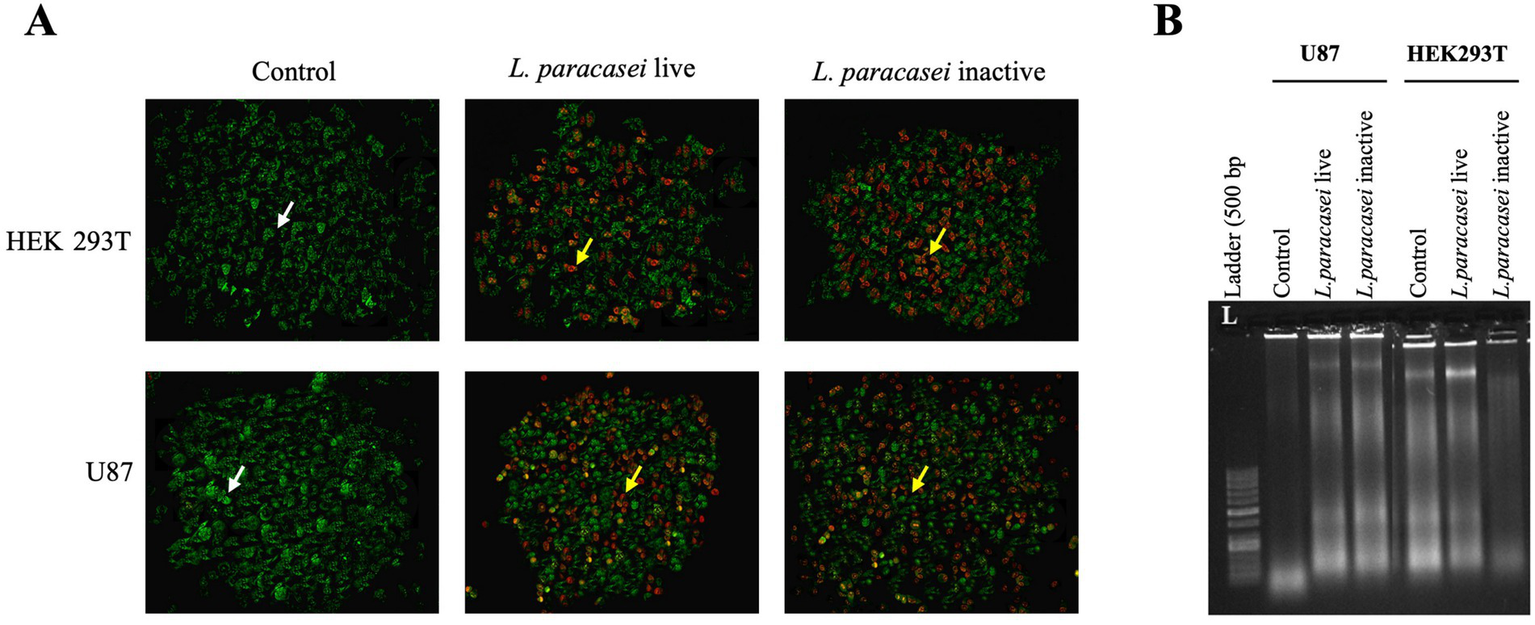 Panel A shows fluorescent microscopy images of HEK 293T and U87 cells with conditions: Control (green cells with white arrows), L. paracasei live, and L. paracasei inactive (green and red cells with yellow arrows). Panel B depicts a gel electrophoresis image with bands for U87 and HEK 293T under the same conditions as described, alongside a DNA ladder marked at five hundred base pairs.