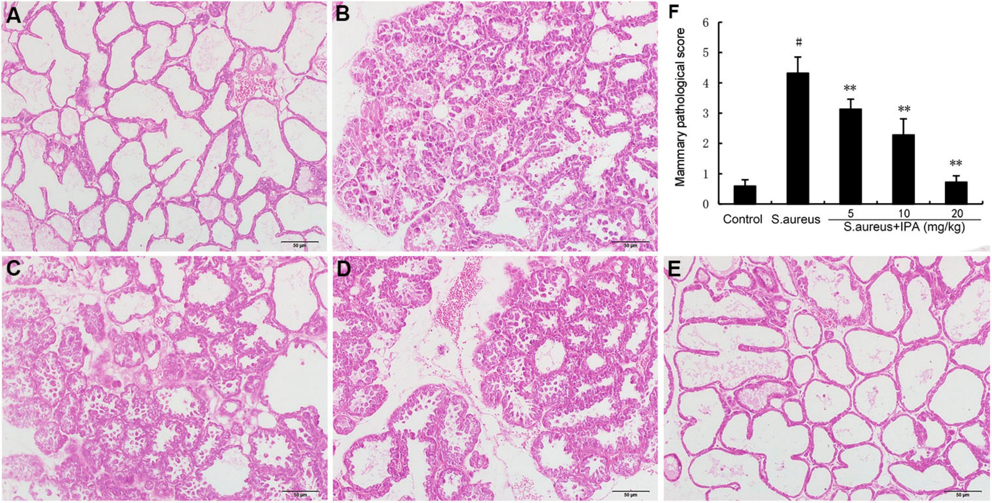 Histological images and a bar graph depicting the effects of different treatments on mammary tissue. Panels A to E show varying degrees of tissue changes due to treatment with Staphylococcus aureus and isopimpinellin (IPA) at different concentrations. Image F is a bar graph illustrating mammary pathological scores for control, S. aureus, and S. aureus with IPA treatment groups, indicating significant differences in effects.