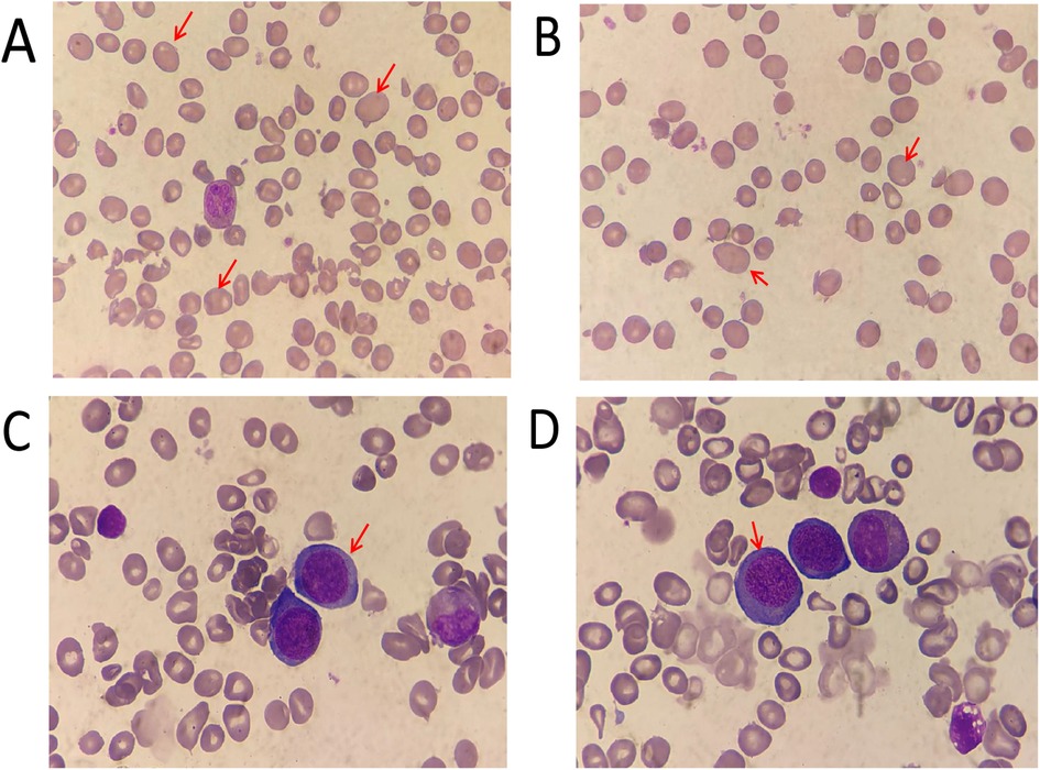 Four panels labeled A through D show microscopic images of blood smears. Each panel displays various blood cells, with red arrows highlighting specific cells or structures. The cells vary in shape and color, with some larger and more prominent, possibly indicating different cell types or abnormalities.