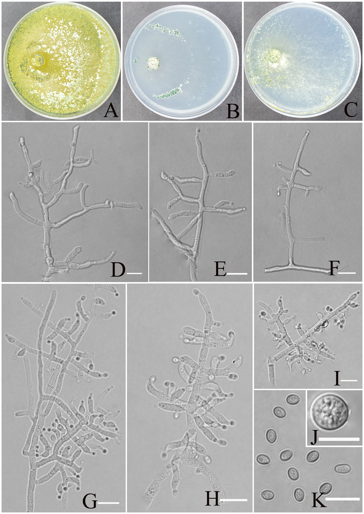 eleven panels depicting fungal growth and microstructures. Panels A, B, and C show petri dishes with colony morphology of the fungus on different culture media. Panels D, E, F, G, H, and I display microscopic views of fungal hyphae in various branching patterns. Panel J contains a close-up of a single chlamydospore or structure. Panel K shows several oval spores scattered in view. Each panel is labeled from A to K.