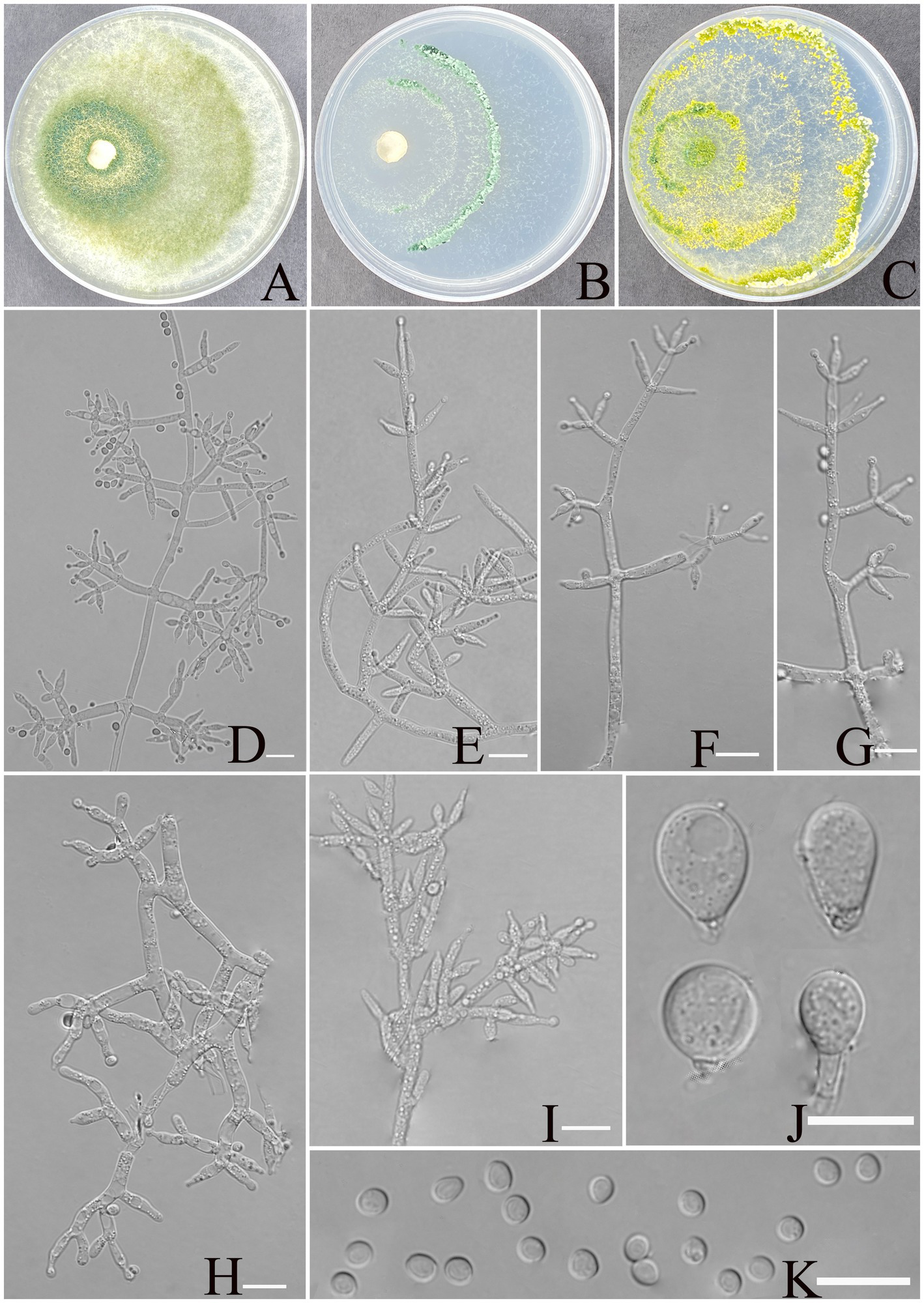Panels A, B, and C show petri dishes with colony morphology of the fungus on different culture media. D to I show microscopic views of fungal structures with branching filaments and spore-like formations. J highlights two distinct chlamydospores shapes, while K shows numerous round spores scattered. Each panel presents a different fungal morphology for examination.