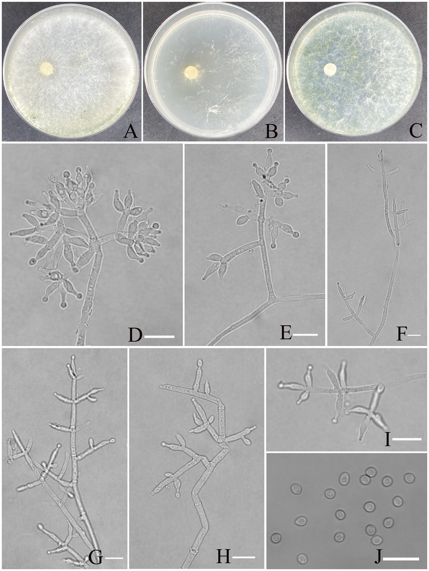 Petri dish cultures (A–C) show fungal colonies with varying morphologies on different petri dishes. Microscopic images (D-I) depict branching hyphae and spore structures, while J shows isolated spores. Each panel represents different samples or stages.