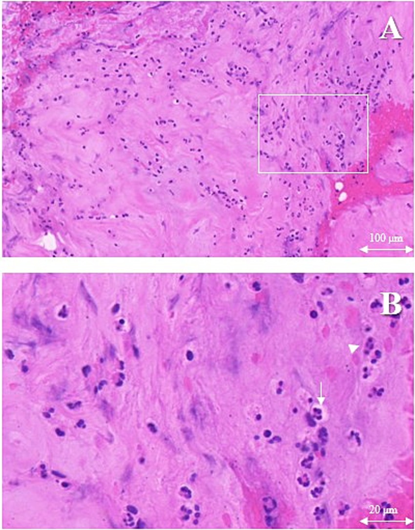 Histological images labeled A and B show a close-up view of tissue samples stained in purple hues. Image A includes a marked rectangular area highlighting specific structures, with a scale bar indicating one hundred micrometers. Image B zooms into the marked area from A, displaying cells in greater detail with a scale bar indicating twenty micrometers.