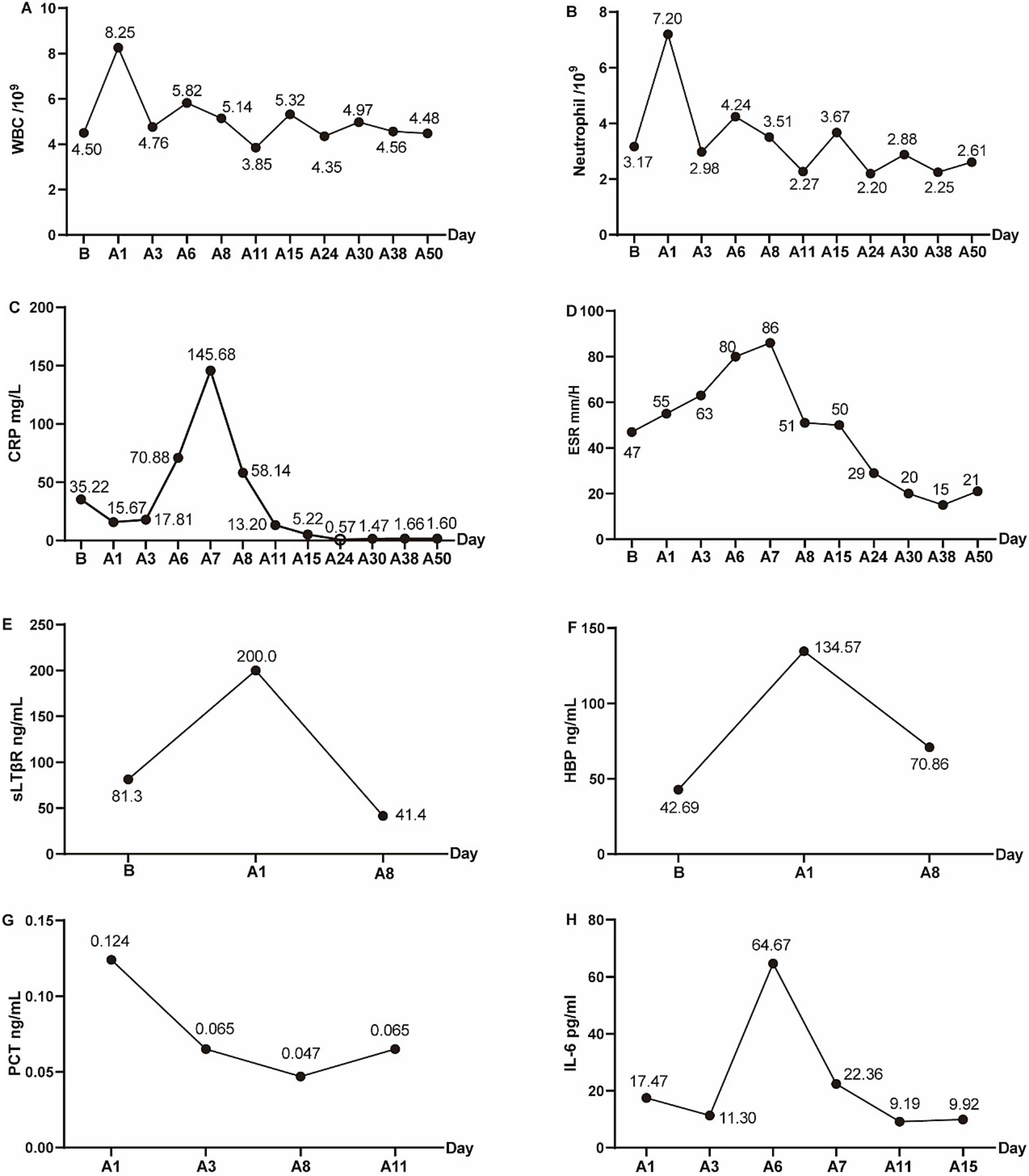 Graphs showing various biomarkers over time. (A) White Blood Cells count fluctuates, peaking at Day A1. (B) Neutrophils peak at Day A1, then decline. (C) C-Reactive Protein spikes at Day A7. (D) Erythrocyte Sedimentation Rate peaks at Day A6. (E) Soluble Tumor Necrosis Factor Receptor peaks at Day A1. (F) Heparin-Binding Protein peaks at Day A1. (G) Procalcitonin levels decrease over time. (H) Interleukin-6 peaks at Day A6. Days are labeled as B, A1 to A50.