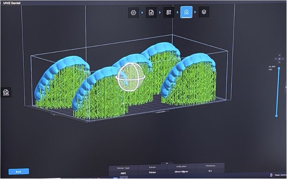 3D modeling software screen displaying dental aligners being prepared for 3D printing. The aligners are positioned within a virtual box, supported by green structural supports. Various icons and settings are visible on the interface.