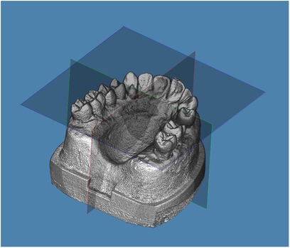 A 3D rendering of a dental model viewed from an angled perspective. The model displays detailed teeth structures set on a base, with intersecting transparent planes over a blue background.