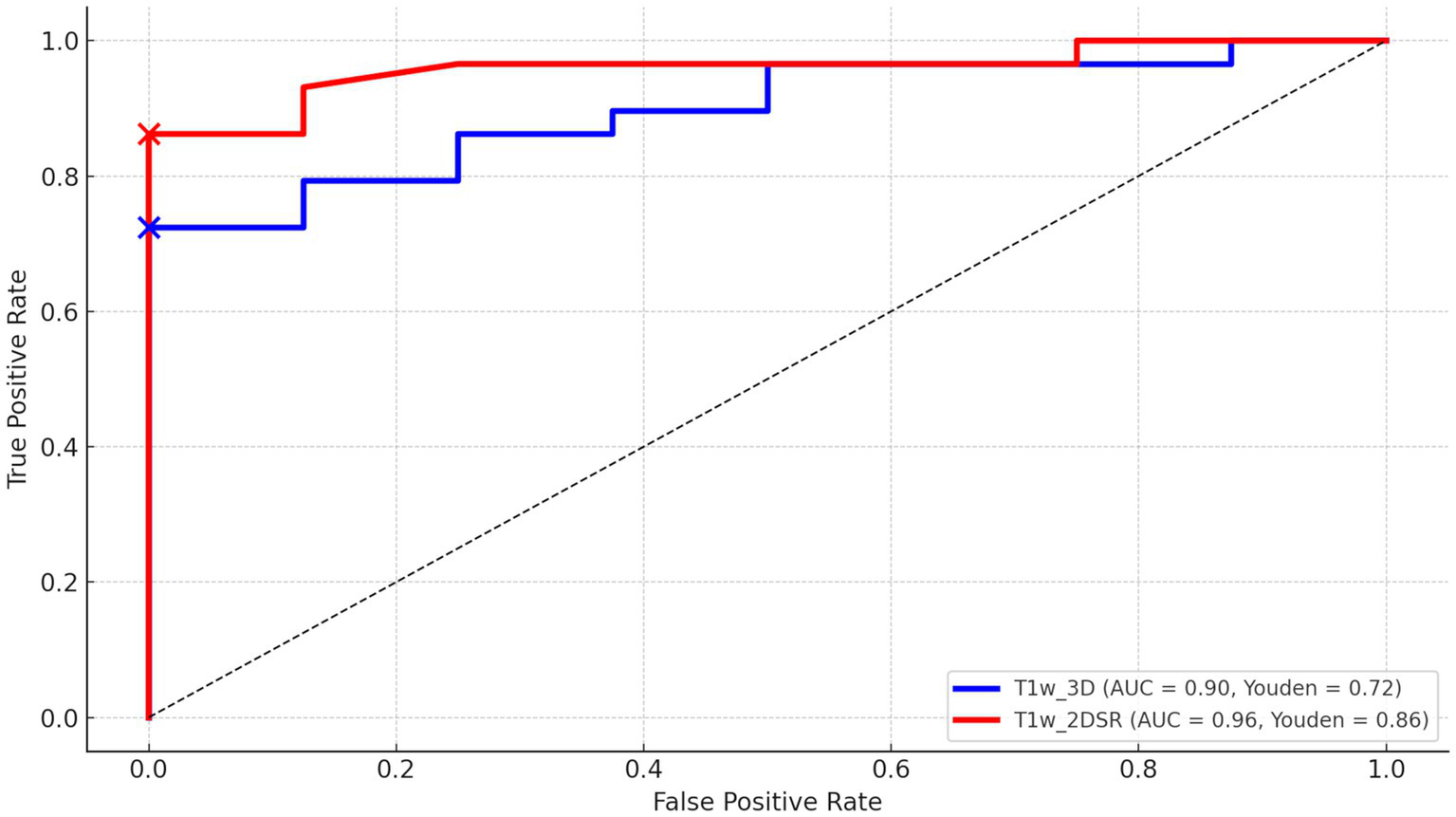Receiver Operating Characteristic (ROC) curve comparing two models. The blue line (T1w 3D) has an AUC of 0.90 and a Youden index of 0.72. The red line (T1w 2DSR) shows an AUC of 0.96 and a Youden index of 0.86. The x-axis represents the false positive rate and the y-axis the true positive rate. The diagonal dashed line indicates random performance.